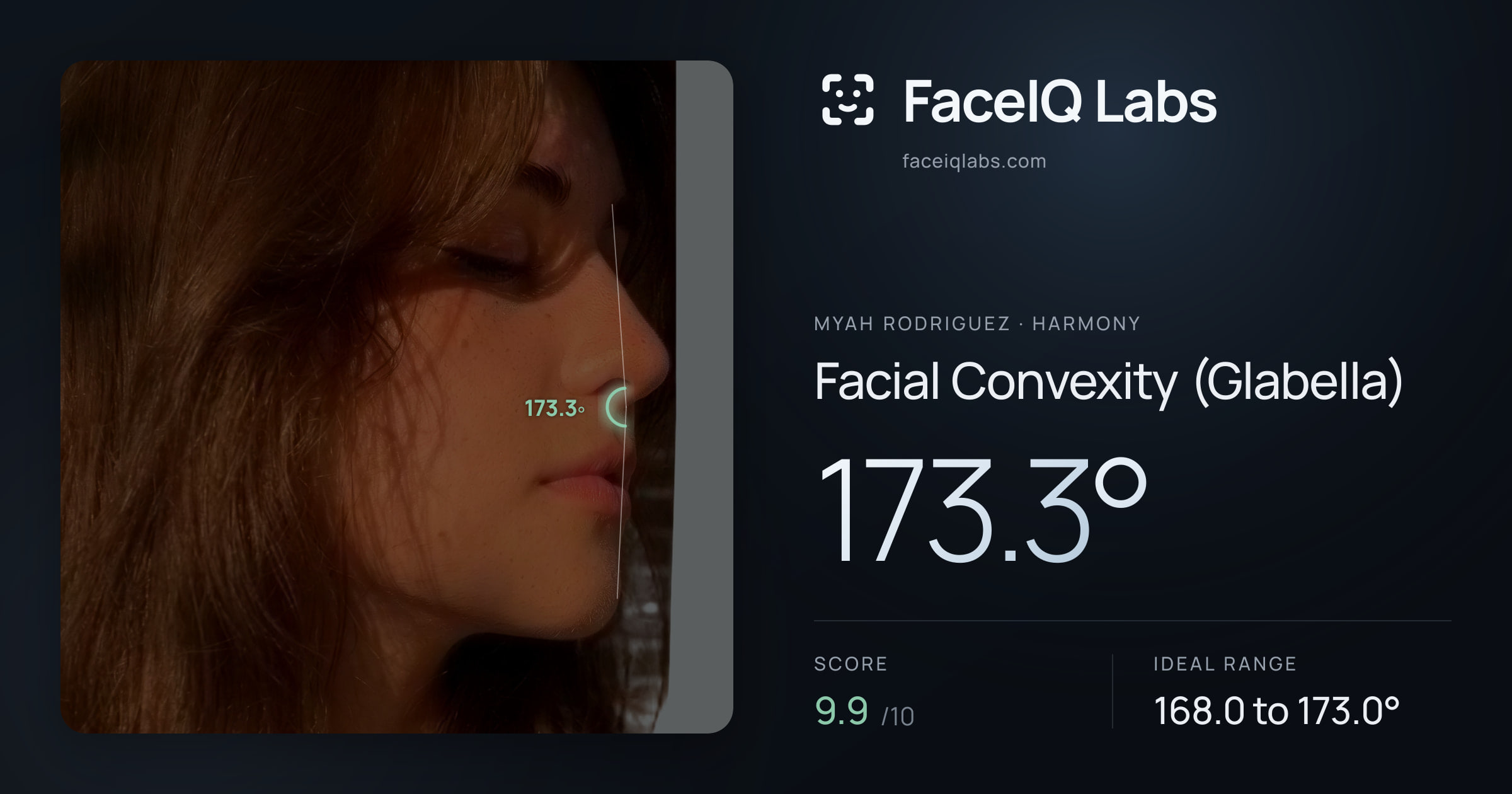 Myah Rodriguez Facial Convexity (Glabella): 173.3°, drawn on the photo