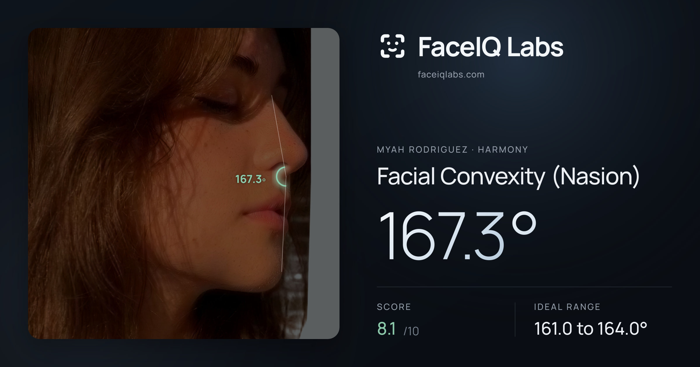 Myah Rodriguez Facial Convexity (Nasion): 167.3°, drawn on the photo