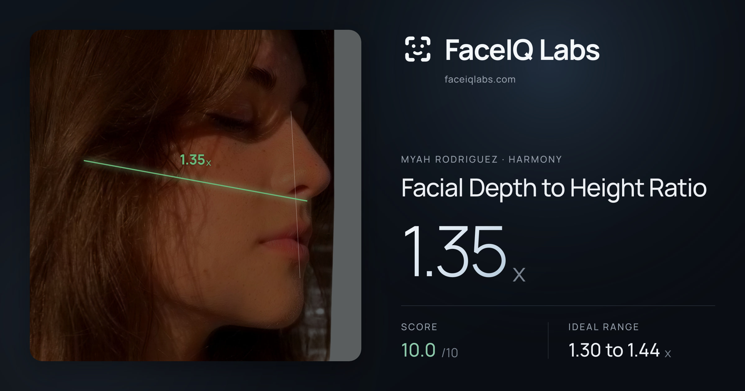 Myah Rodriguez Facial Depth to Height Ratio: 1.35x, drawn on the photo