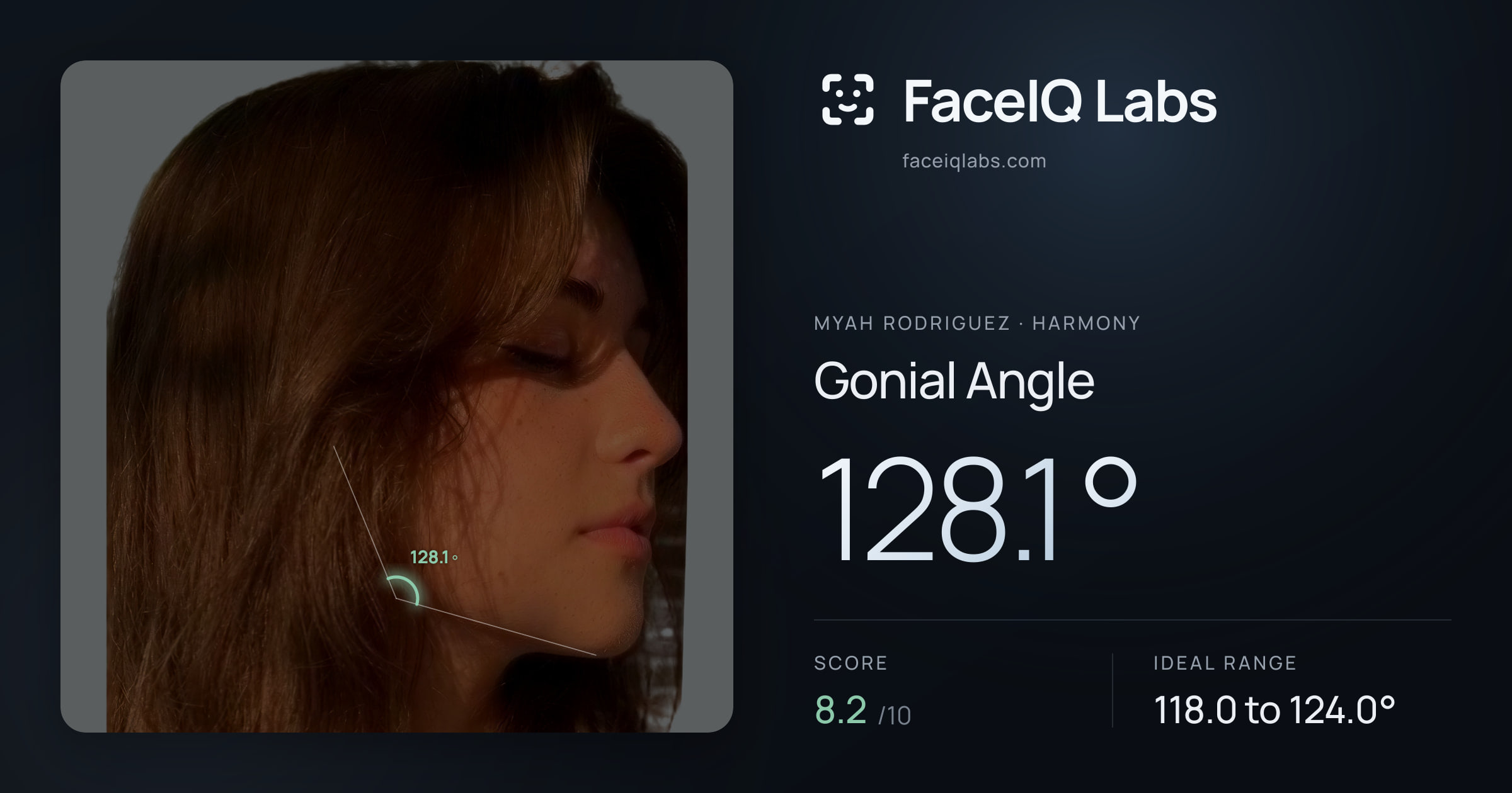 Myah Rodriguez Gonial Angle: 128.1°, drawn on the photo