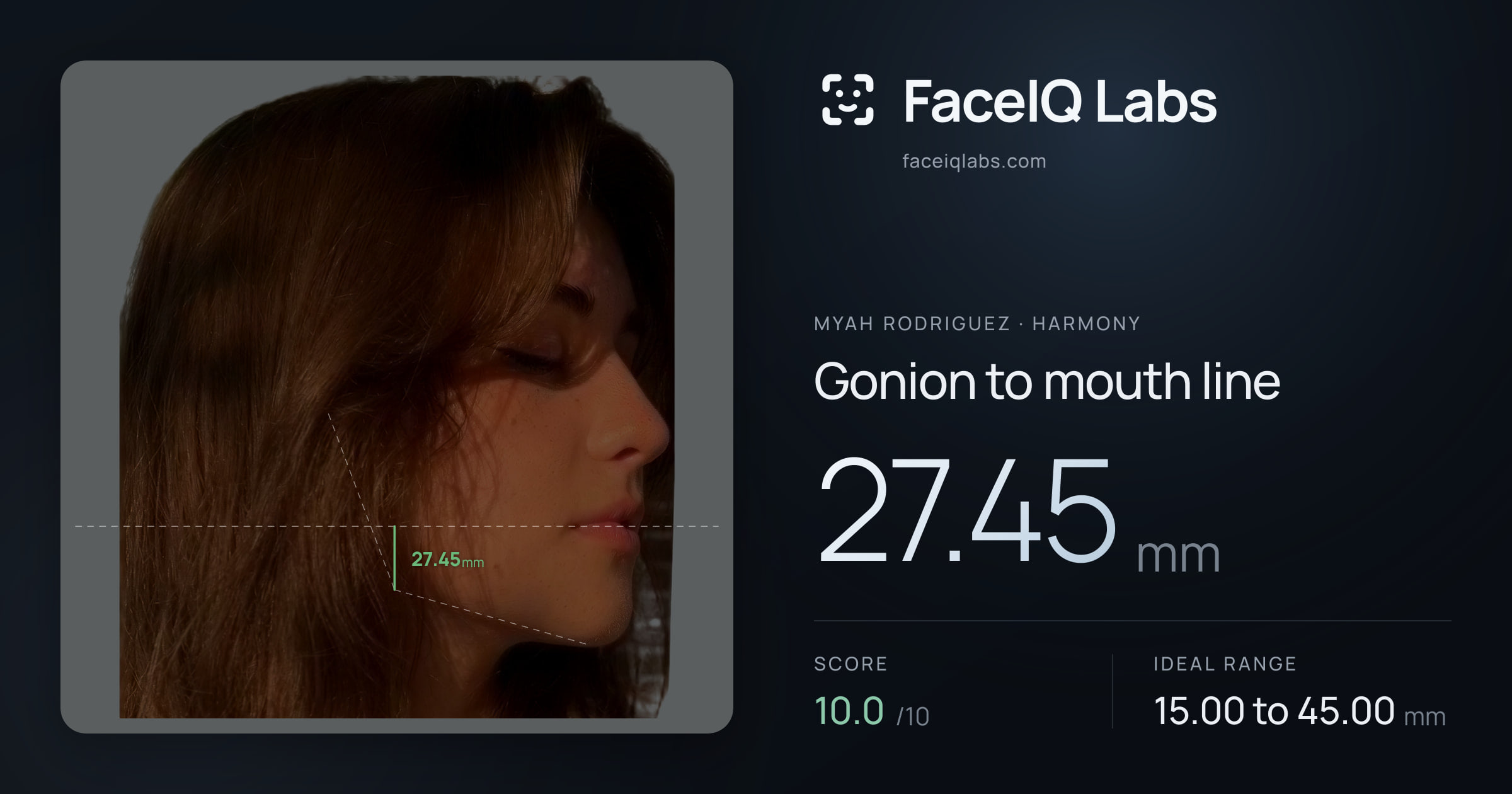 Myah Rodriguez Gonion to mouth line: 27.45mm, drawn on the photo