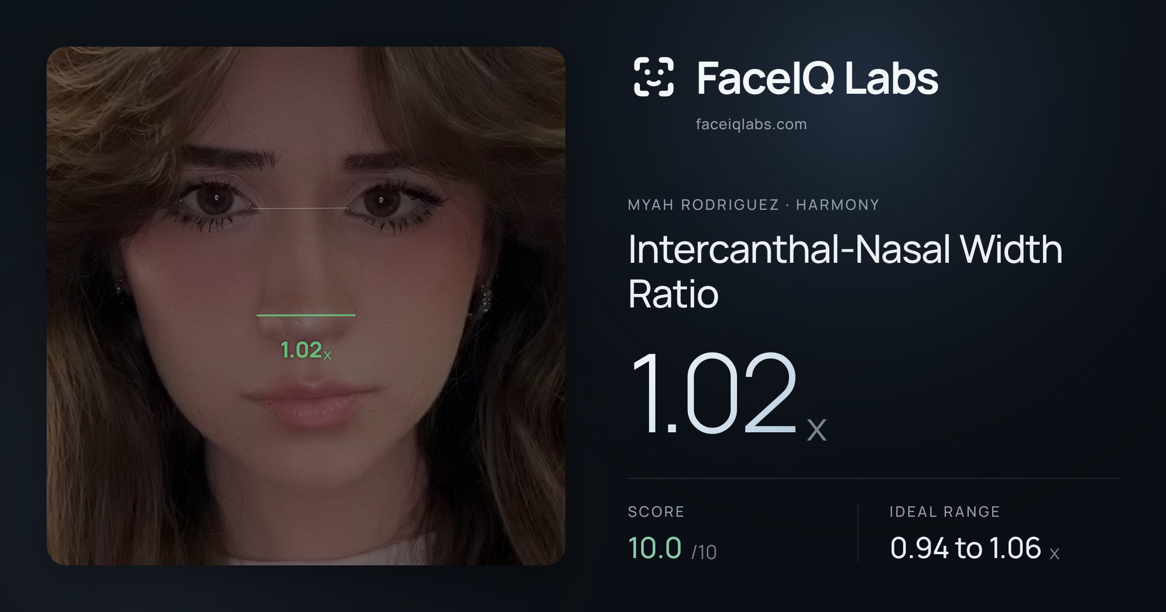 Myah Rodriguez Intercanthal-Nasal Width Ratio: 1.02x, drawn on the photo