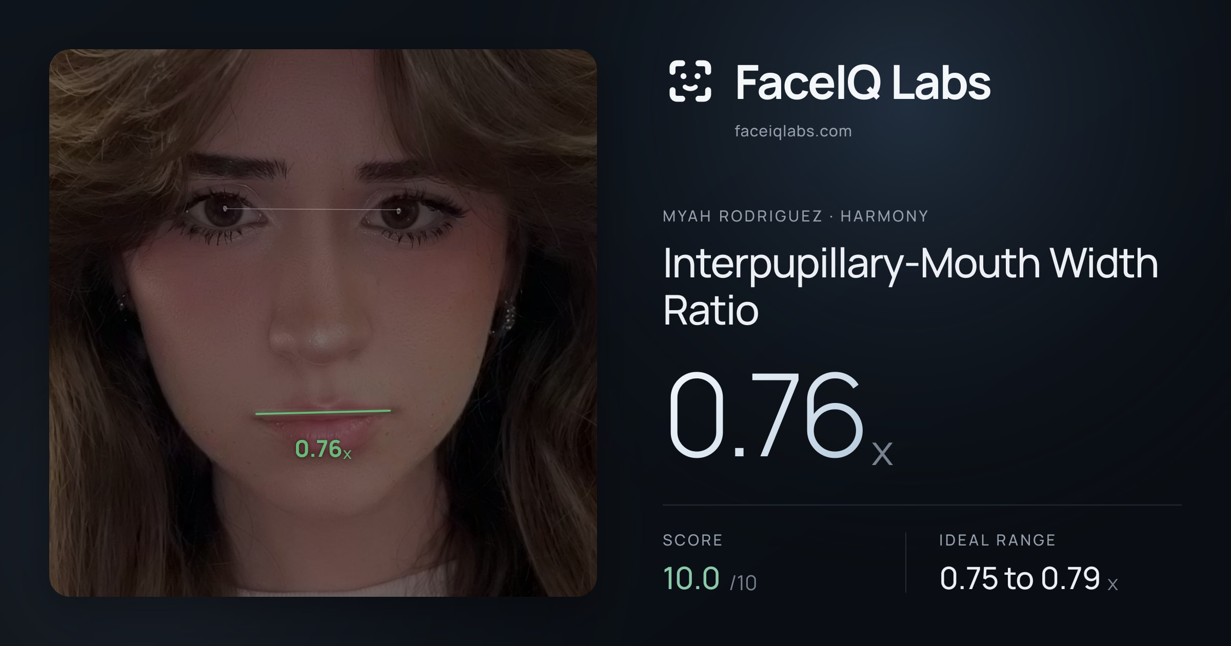 Myah Rodriguez Interpupillary-Mouth Width Ratio: 0.76x, drawn on the photo