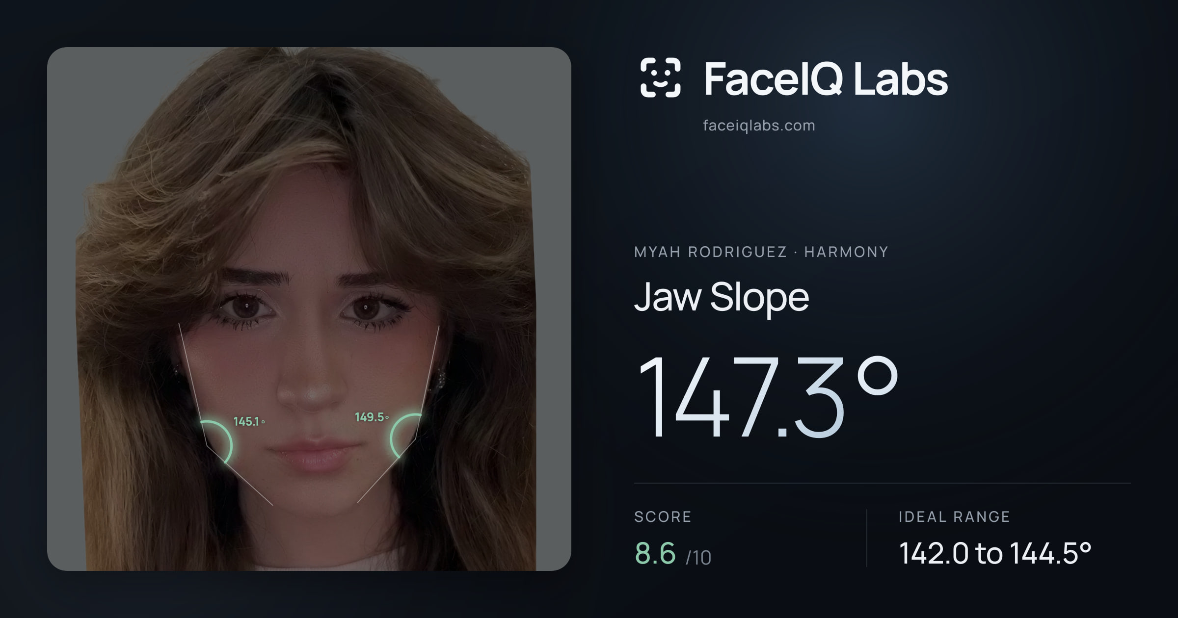 Myah Rodriguez Jaw Slope: 147.3°, drawn on the photo