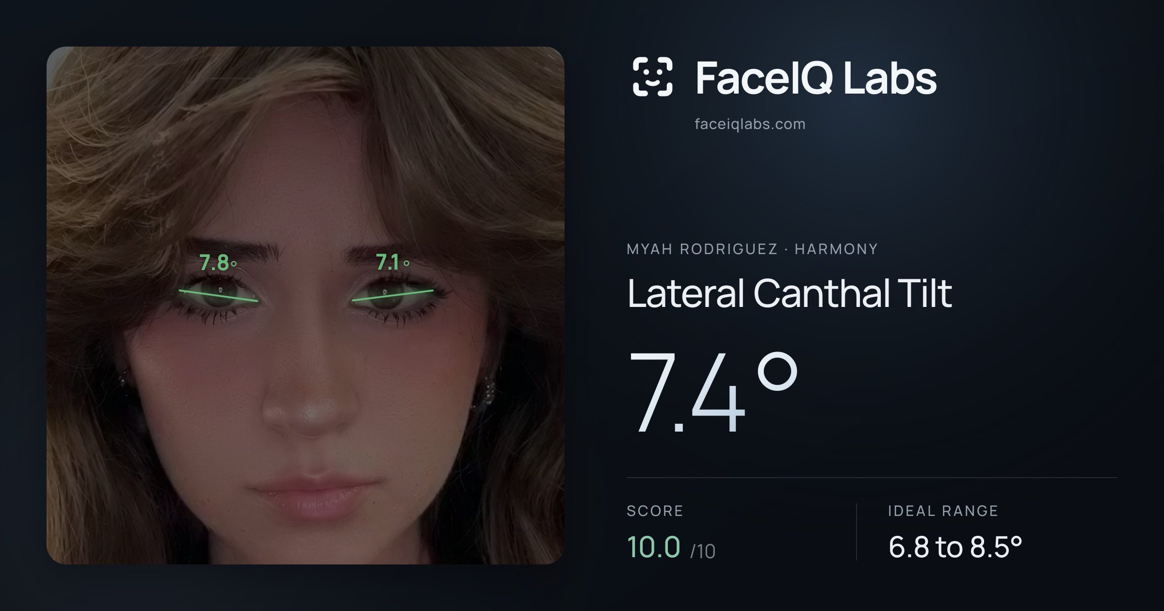 Myah Rodriguez Lateral Canthal Tilt: 7.4°, drawn on the photo