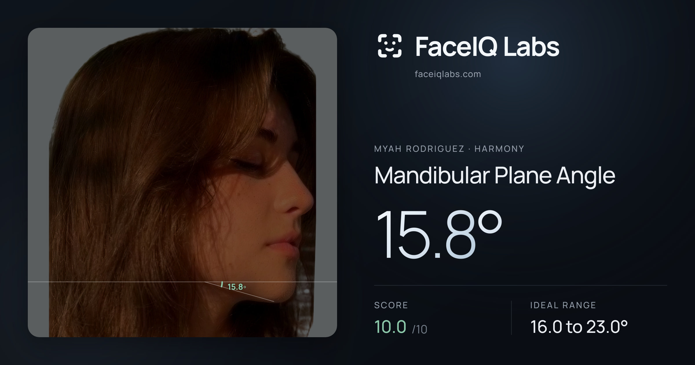 Myah Rodriguez Mandibular Plane Angle: 15.8°, drawn on the photo