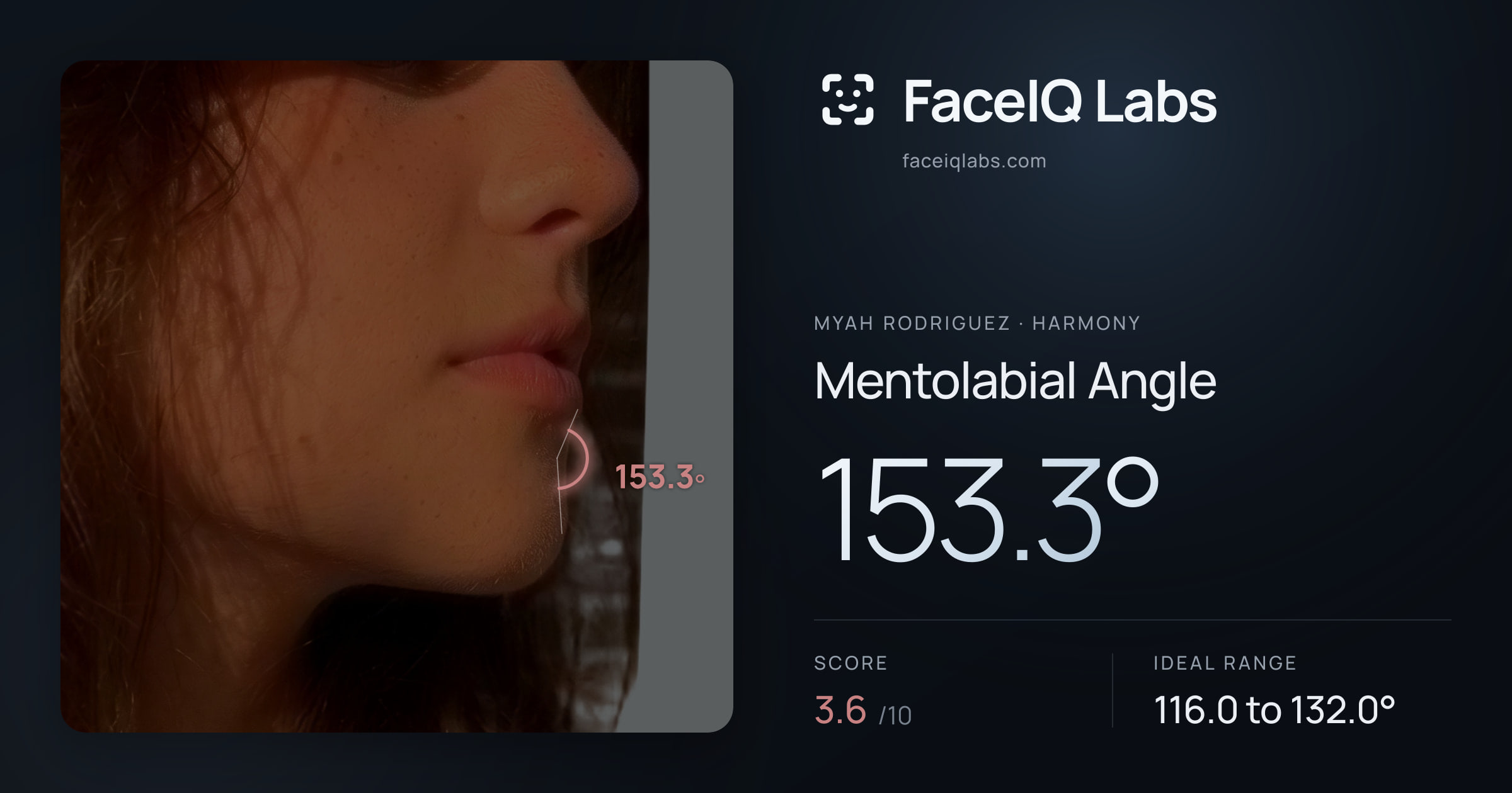 Myah Rodriguez Mentolabial Angle: 153.3°, drawn on the photo