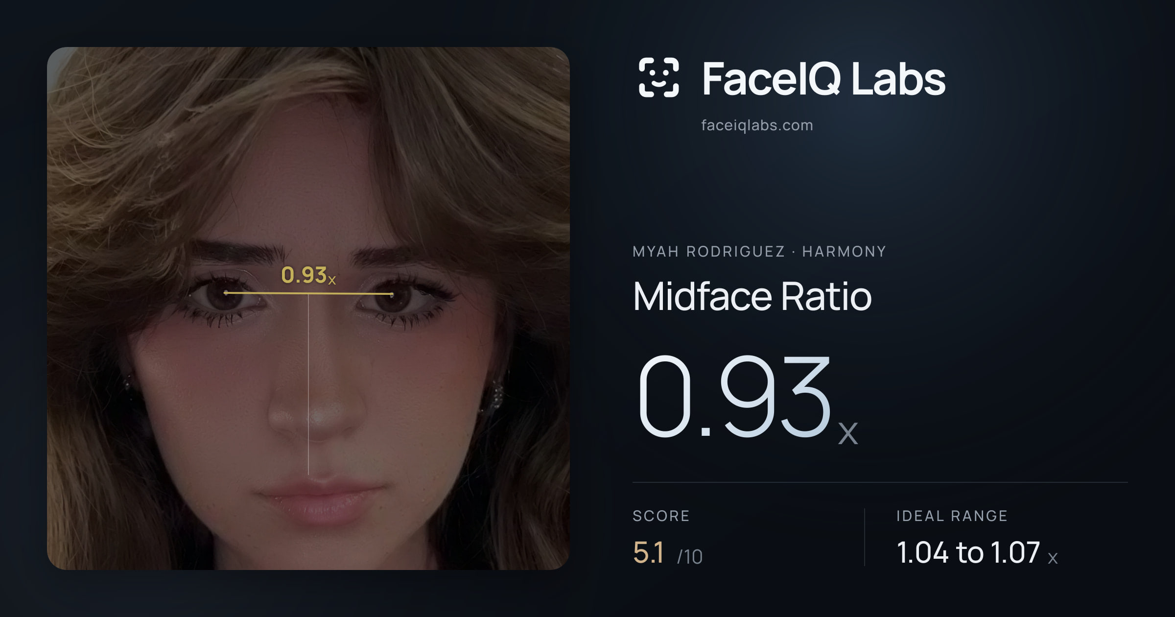 Myah Rodriguez Midface Ratio: 0.93x, drawn on the photo