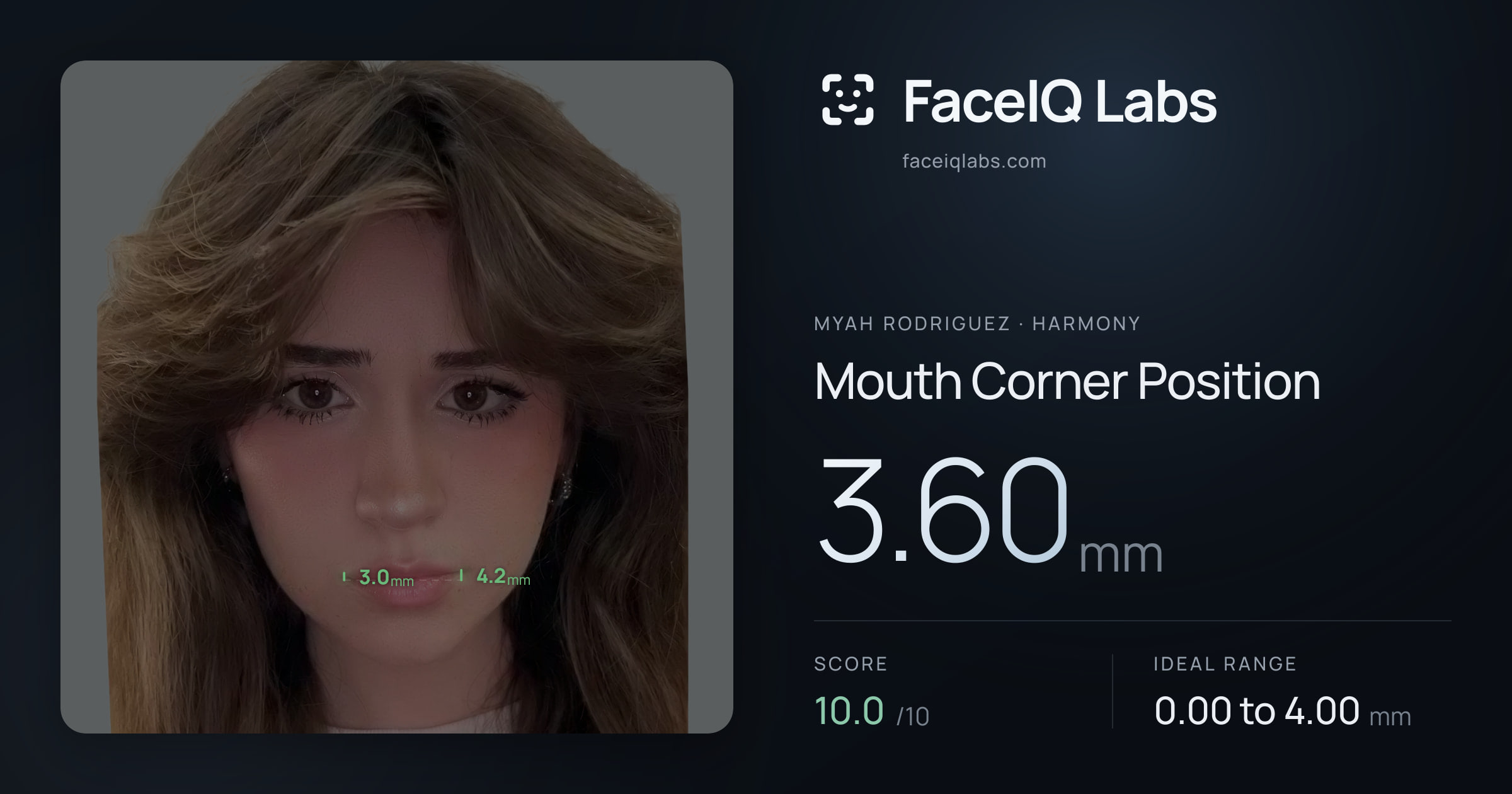 Myah Rodriguez Mouth Corner Position: 3.60mm, drawn on the photo