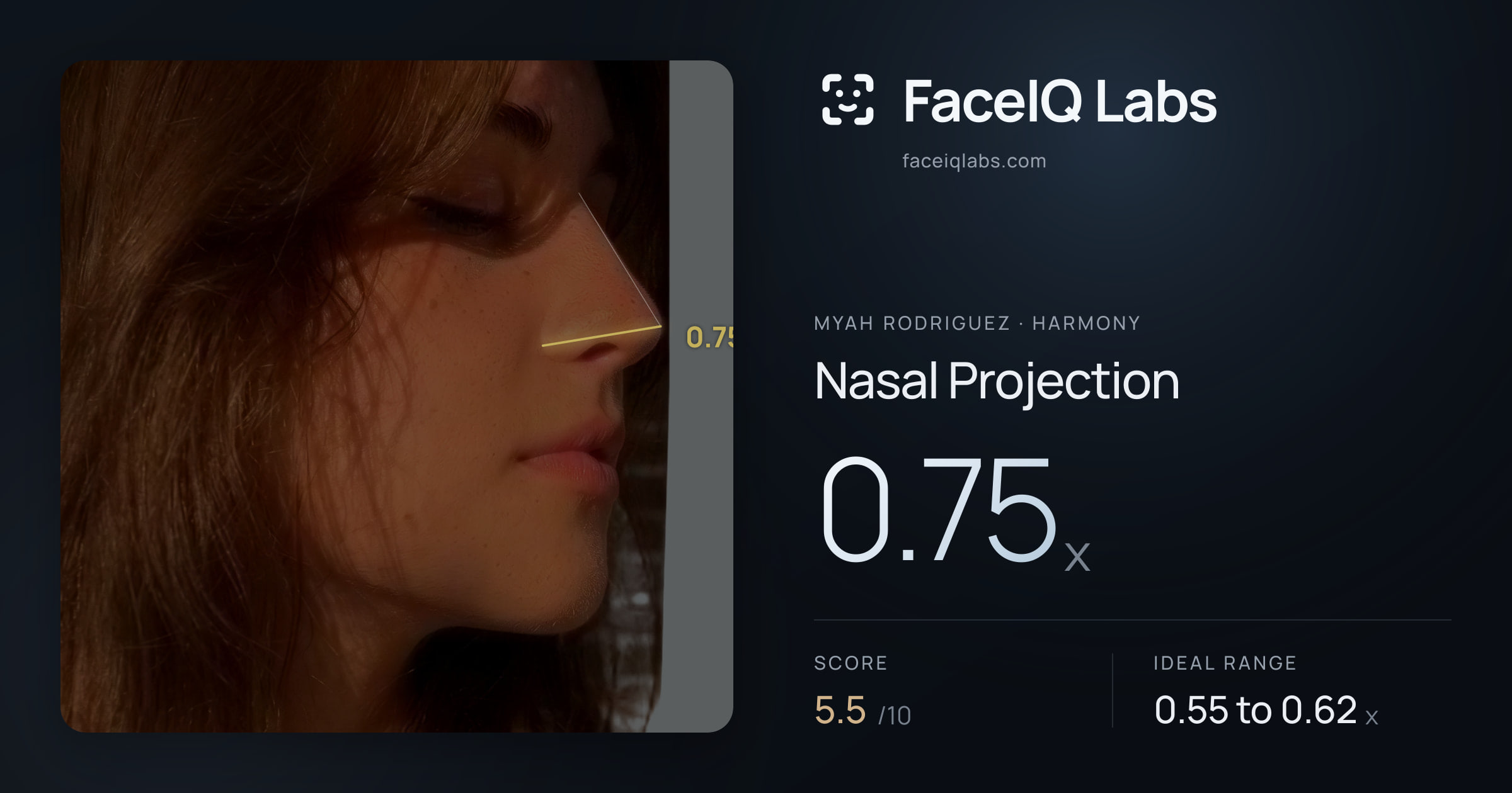 Myah Rodriguez Nasal Projection: 0.75x, drawn on the photo