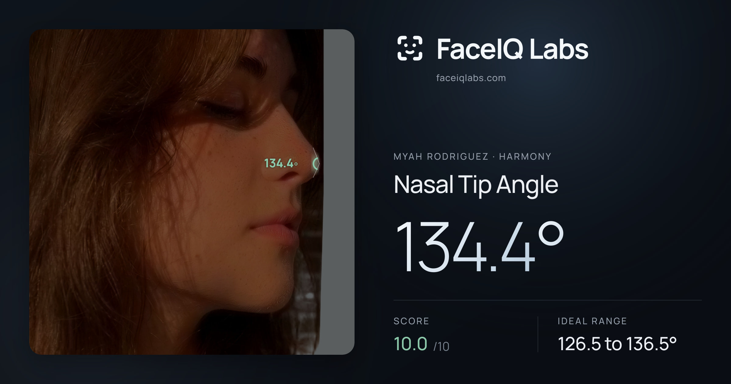 Myah Rodriguez Nasal Tip Angle: 134.4°, drawn on the photo