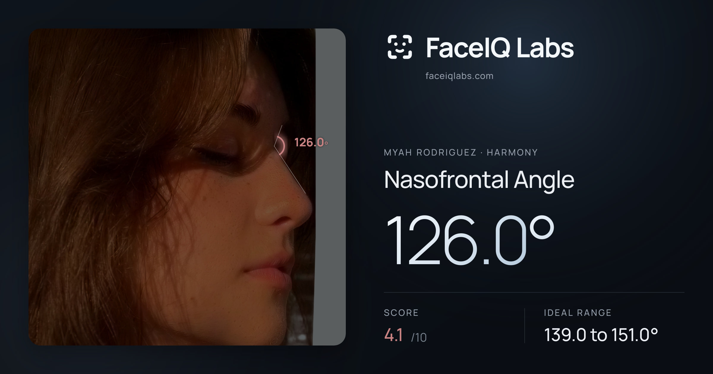 Myah Rodriguez Nasofrontal Angle: 126.0°, drawn on the photo