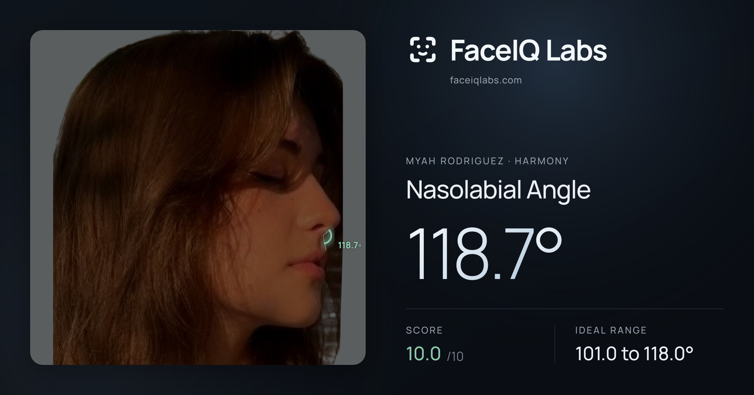 Myah Rodriguez Nasolabial Angle: 118.7°, drawn on the photo