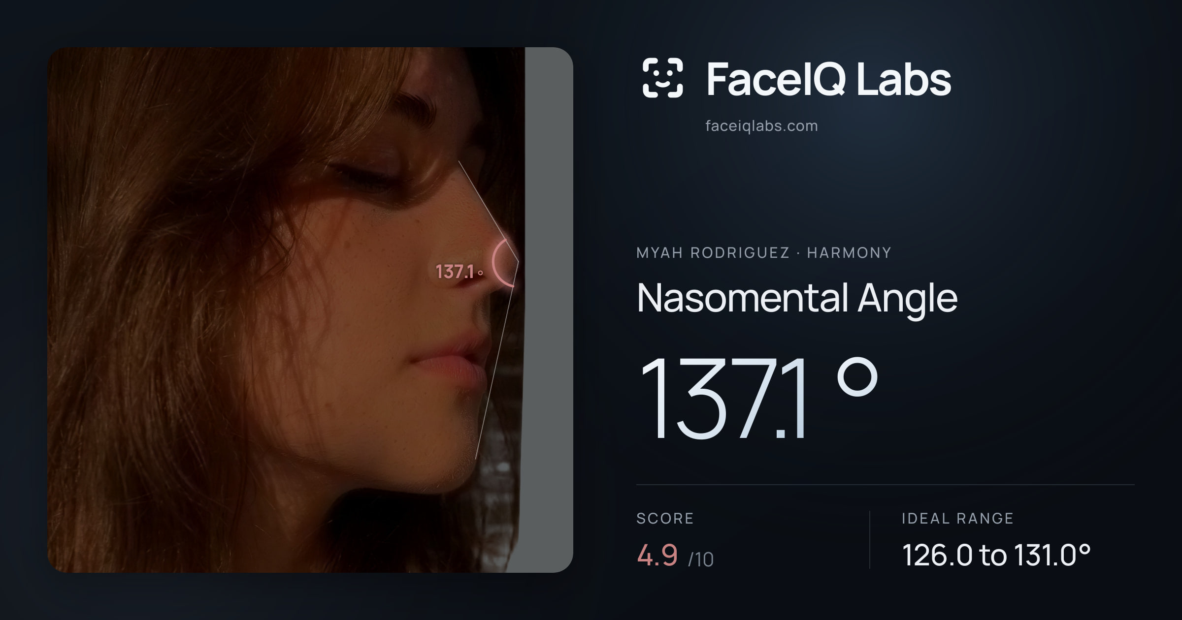 Myah Rodriguez Nasomental Angle: 137.1°, drawn on the photo