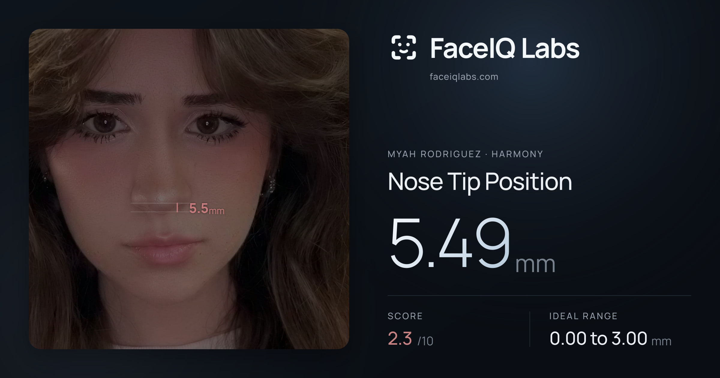 Myah Rodriguez Nose Tip Position: 5.49mm, drawn on the photo