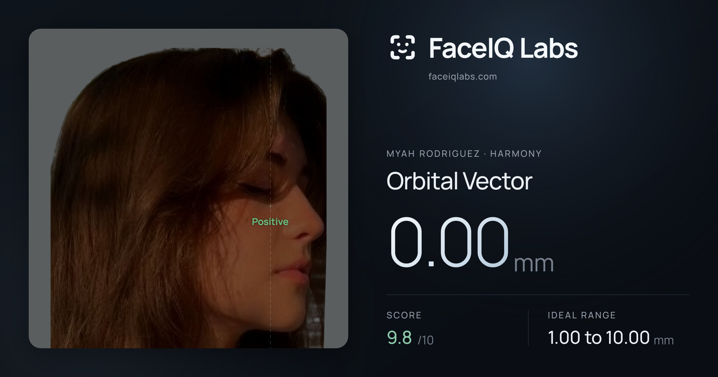 Myah Rodriguez Orbital Vector: 0.00mm, drawn on the photo
