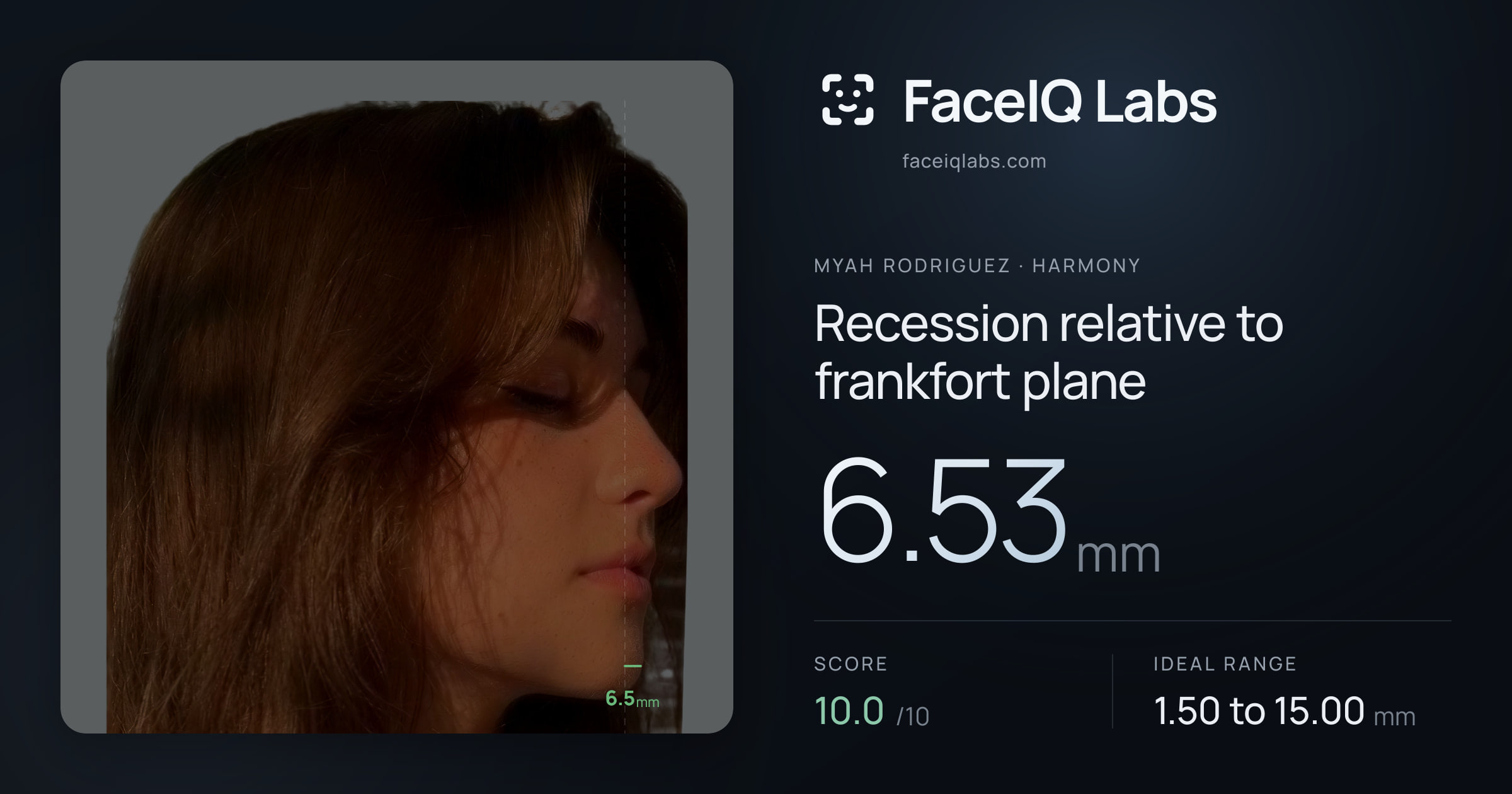 Myah Rodriguez Recession relative to frankfort plane: 6.53mm, drawn on the photo