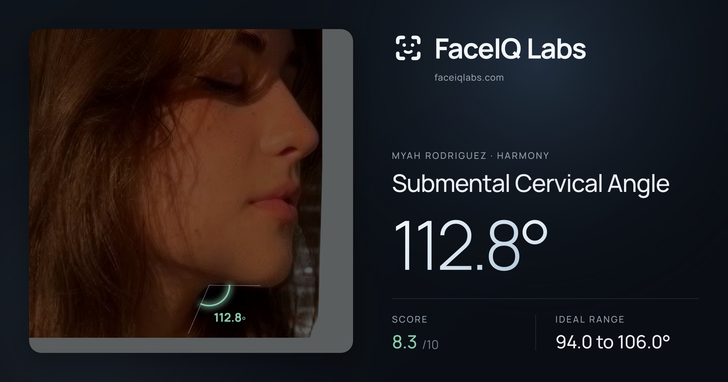 Myah Rodriguez Submental Cervical Angle: 112.8°, drawn on the photo