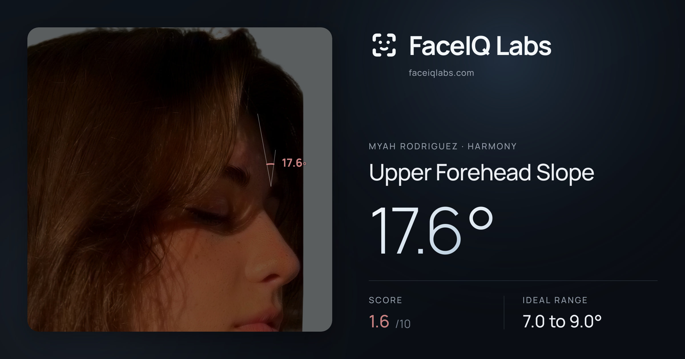 Myah Rodriguez Upper Forehead Slope: 17.6°, drawn on the photo