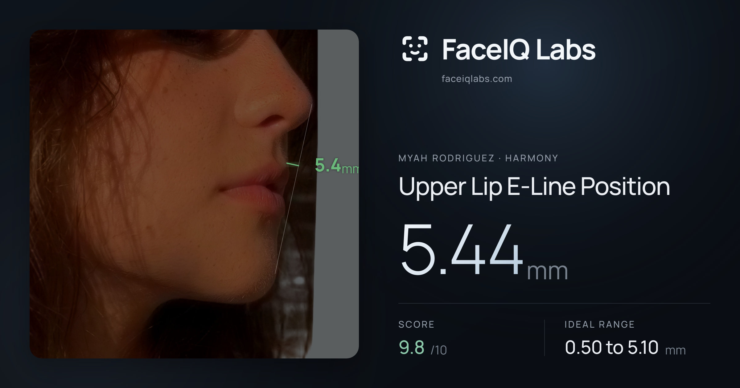 Myah Rodriguez Upper Lip E-Line Position: 5.44mm, drawn on the photo