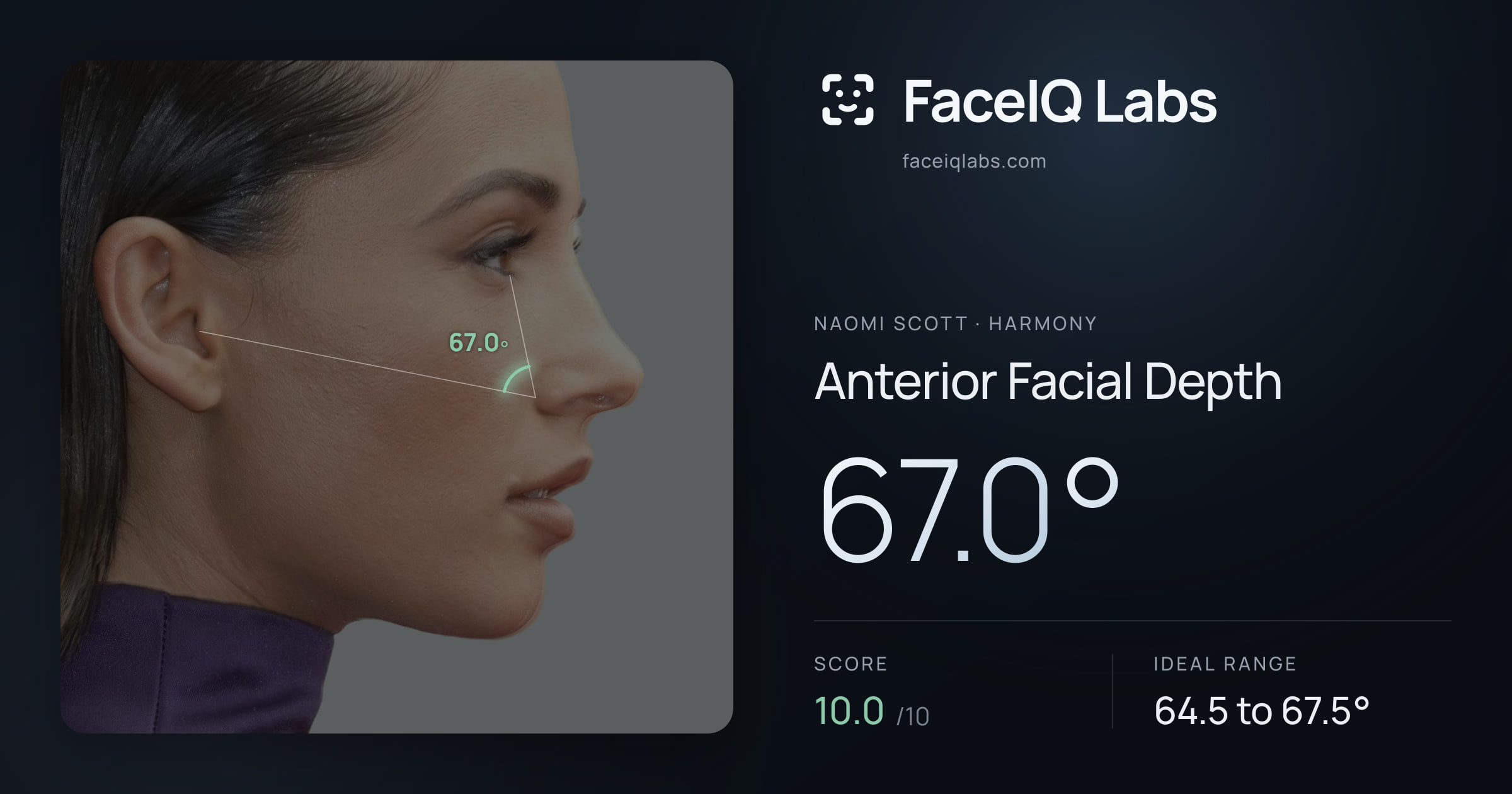 Naomi Scott Anterior Facial Depth: 67.0°, drawn on the photo