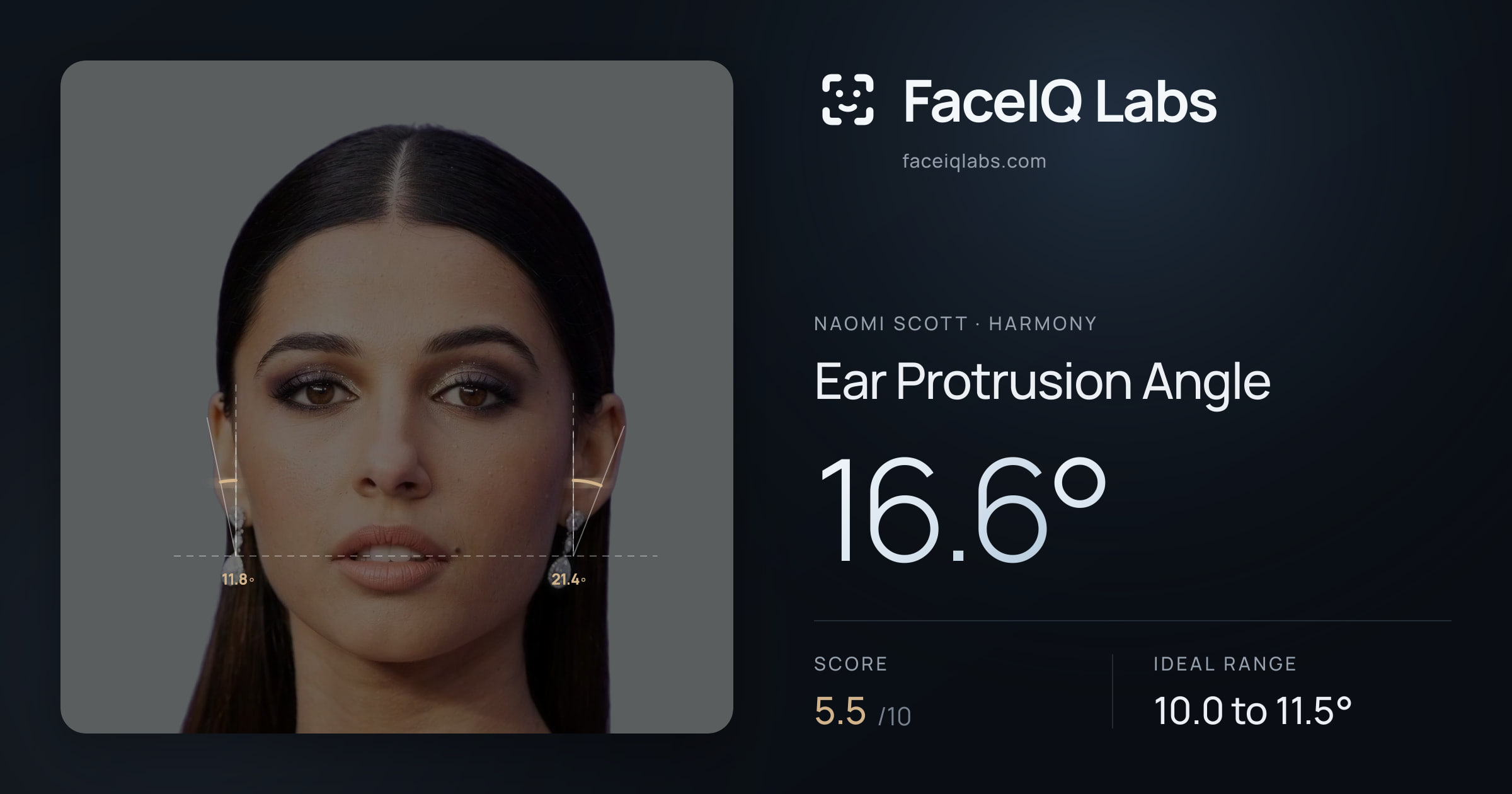 Naomi Scott Ear Protrusion Angle: 16.6°, drawn on the photo