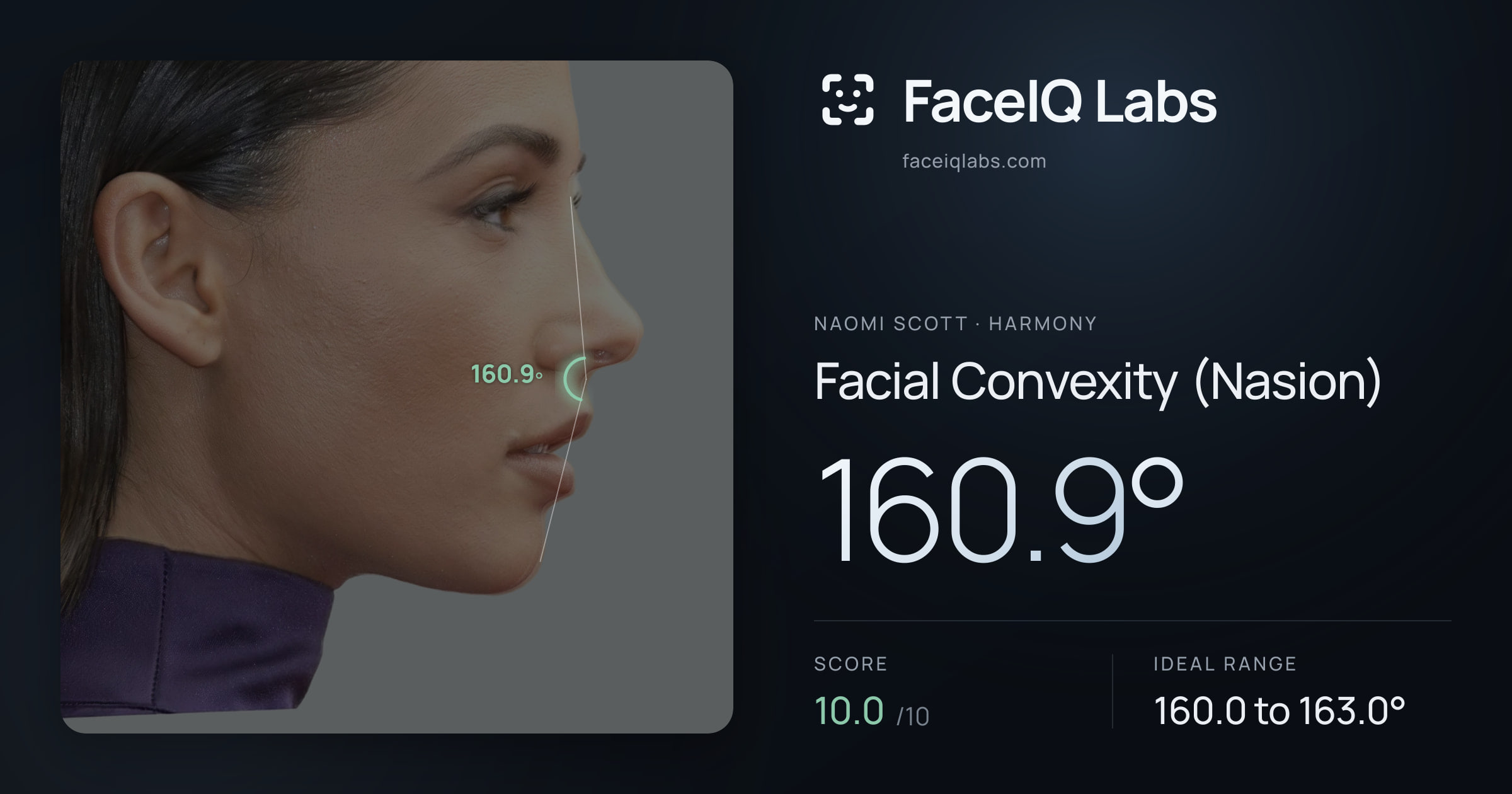 Naomi Scott Facial Convexity (Nasion): 160.9°, drawn on the photo