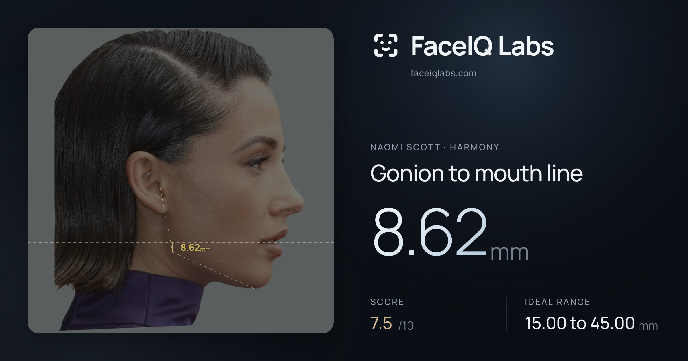 Naomi Scott Gonion to mouth line: 8.62mm, drawn on the photo