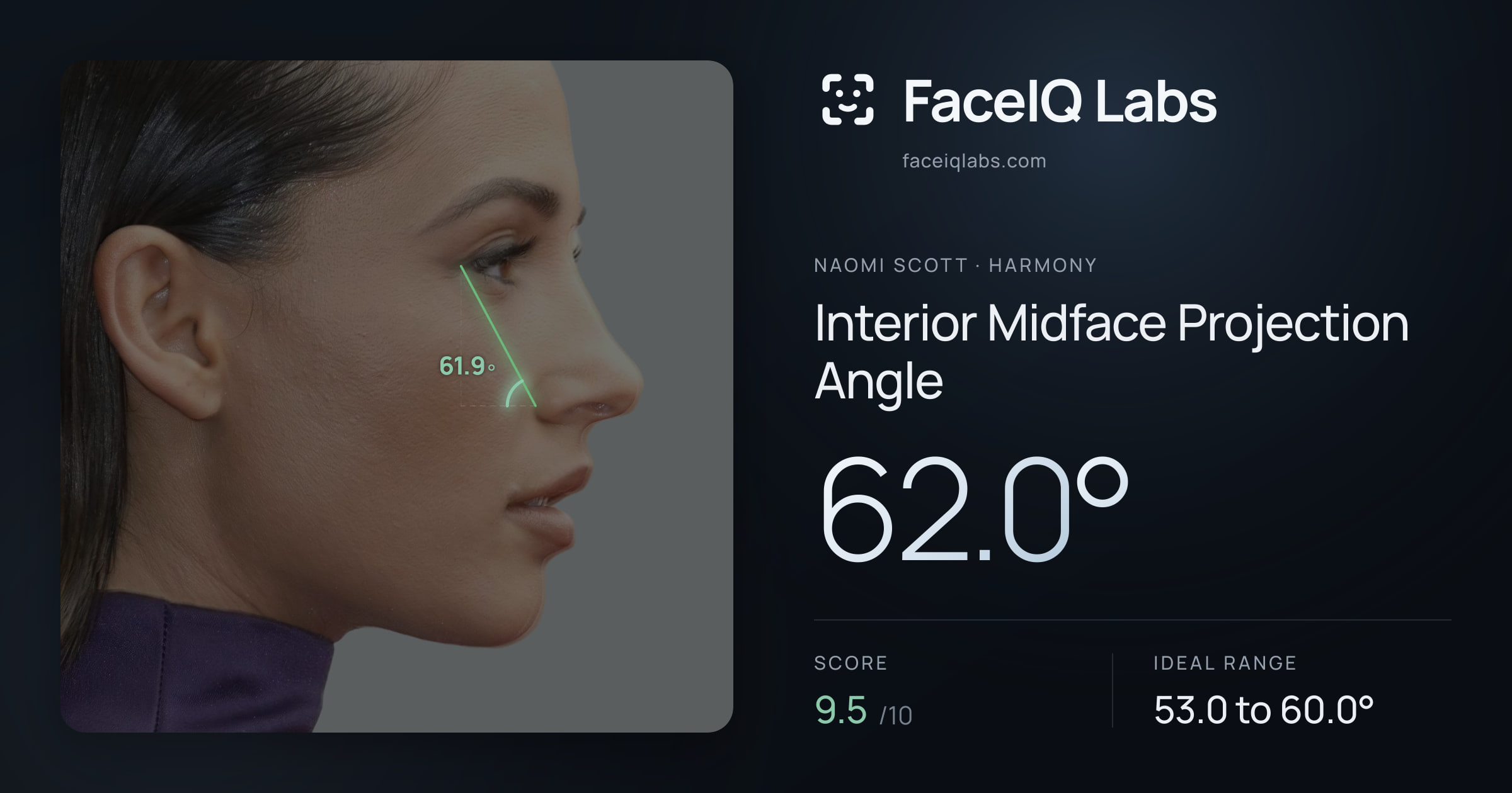 Naomi Scott Interior Midface Projection Angle: 62.0°, drawn on the photo