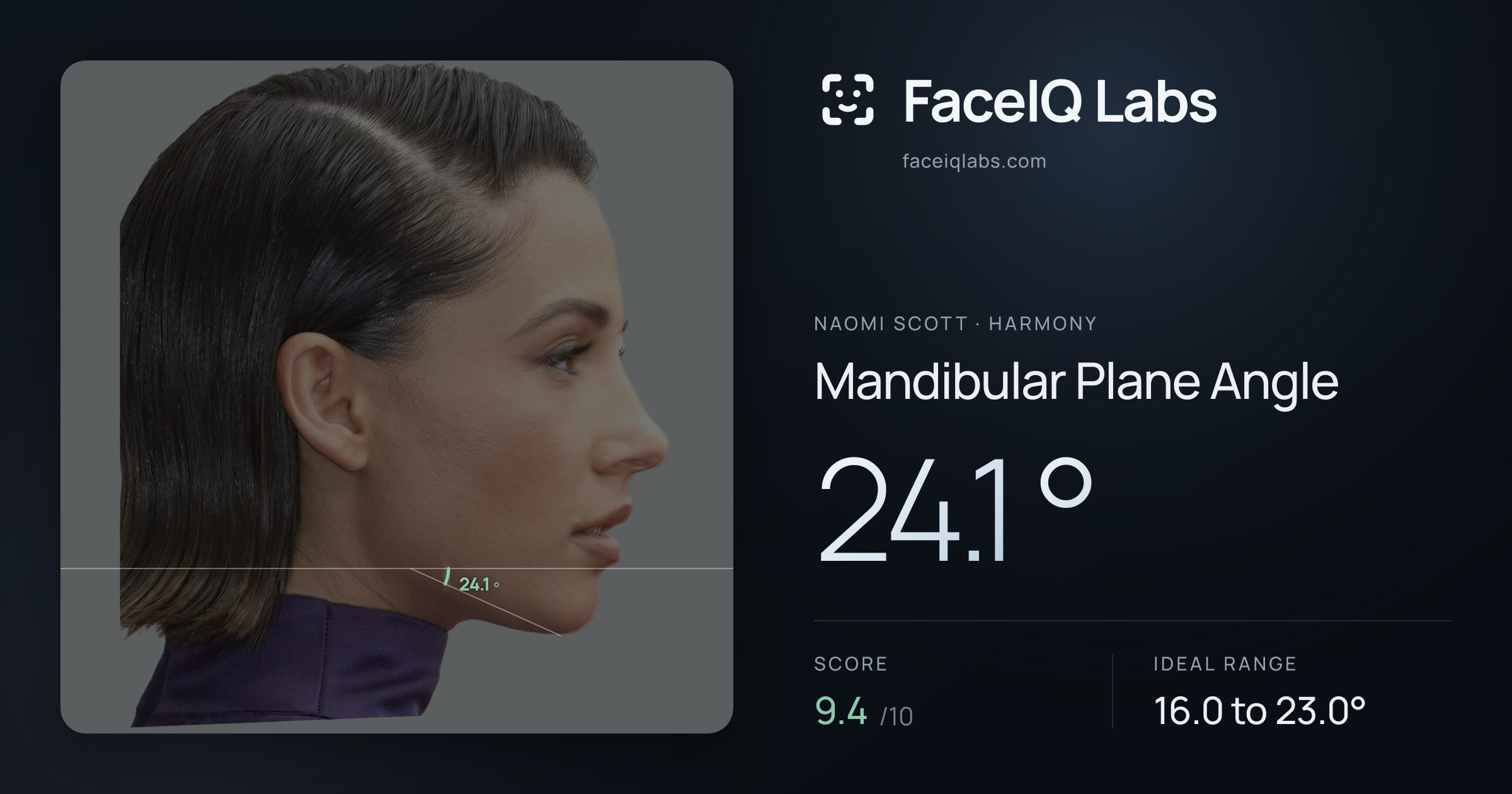Naomi Scott Mandibular Plane Angle: 24.1°, drawn on the photo