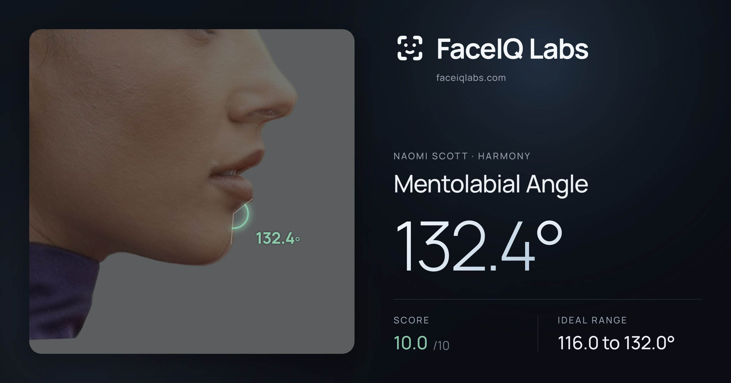Naomi Scott Mentolabial Angle: 132.4°, drawn on the photo