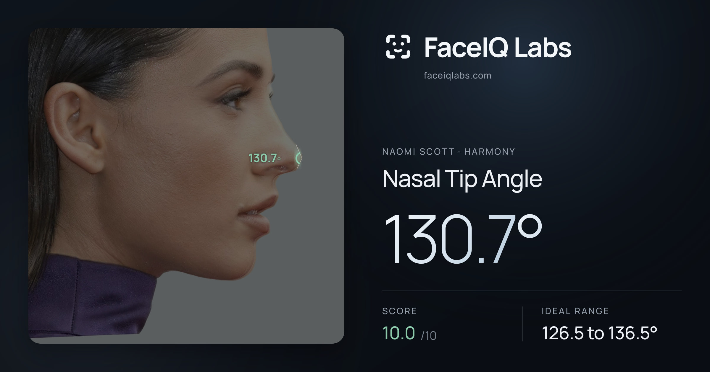 Naomi Scott Nasal Tip Angle: 130.7°, drawn on the photo