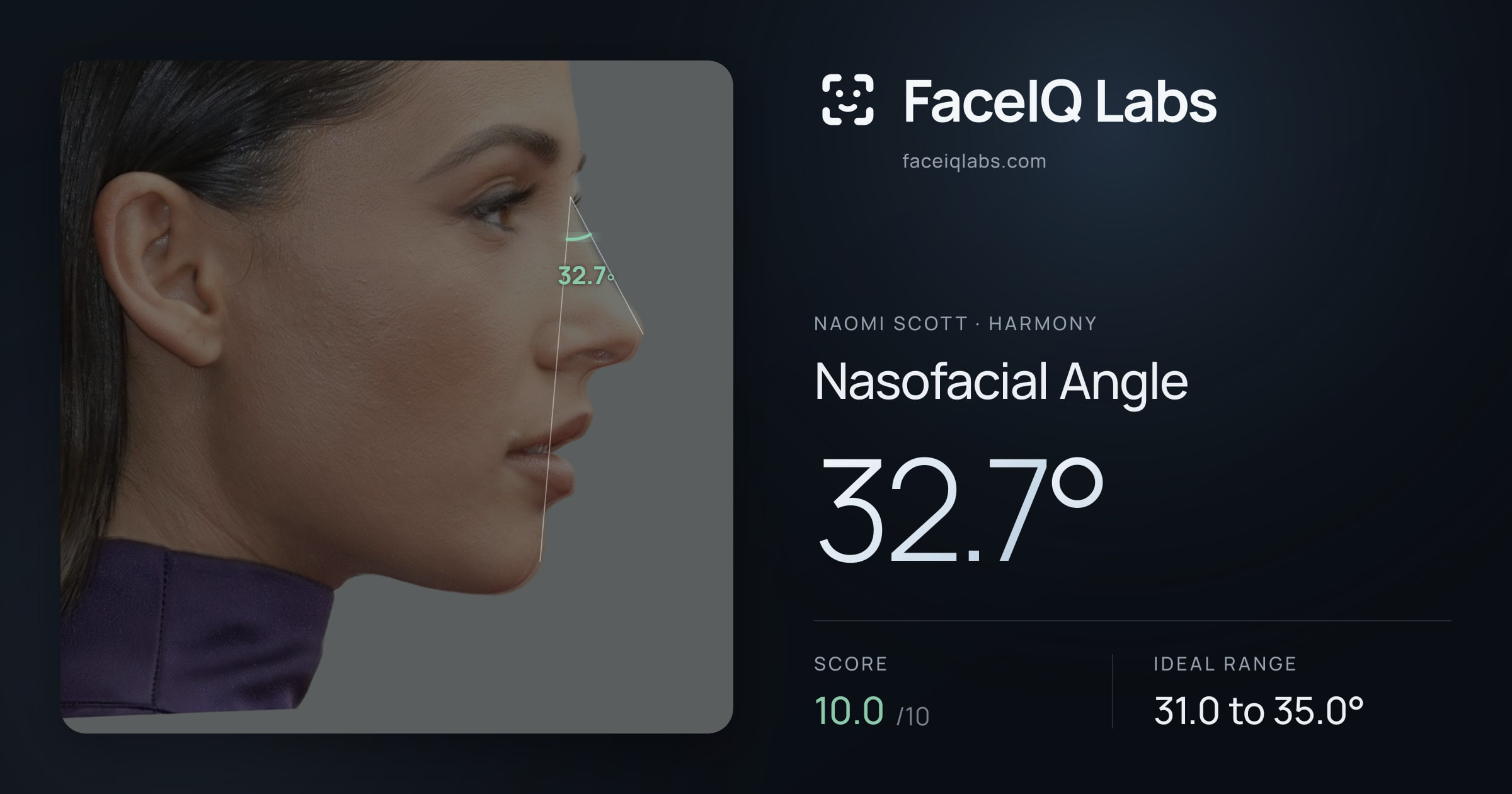 Naomi Scott Nasofacial Angle: 32.7°, drawn on the photo