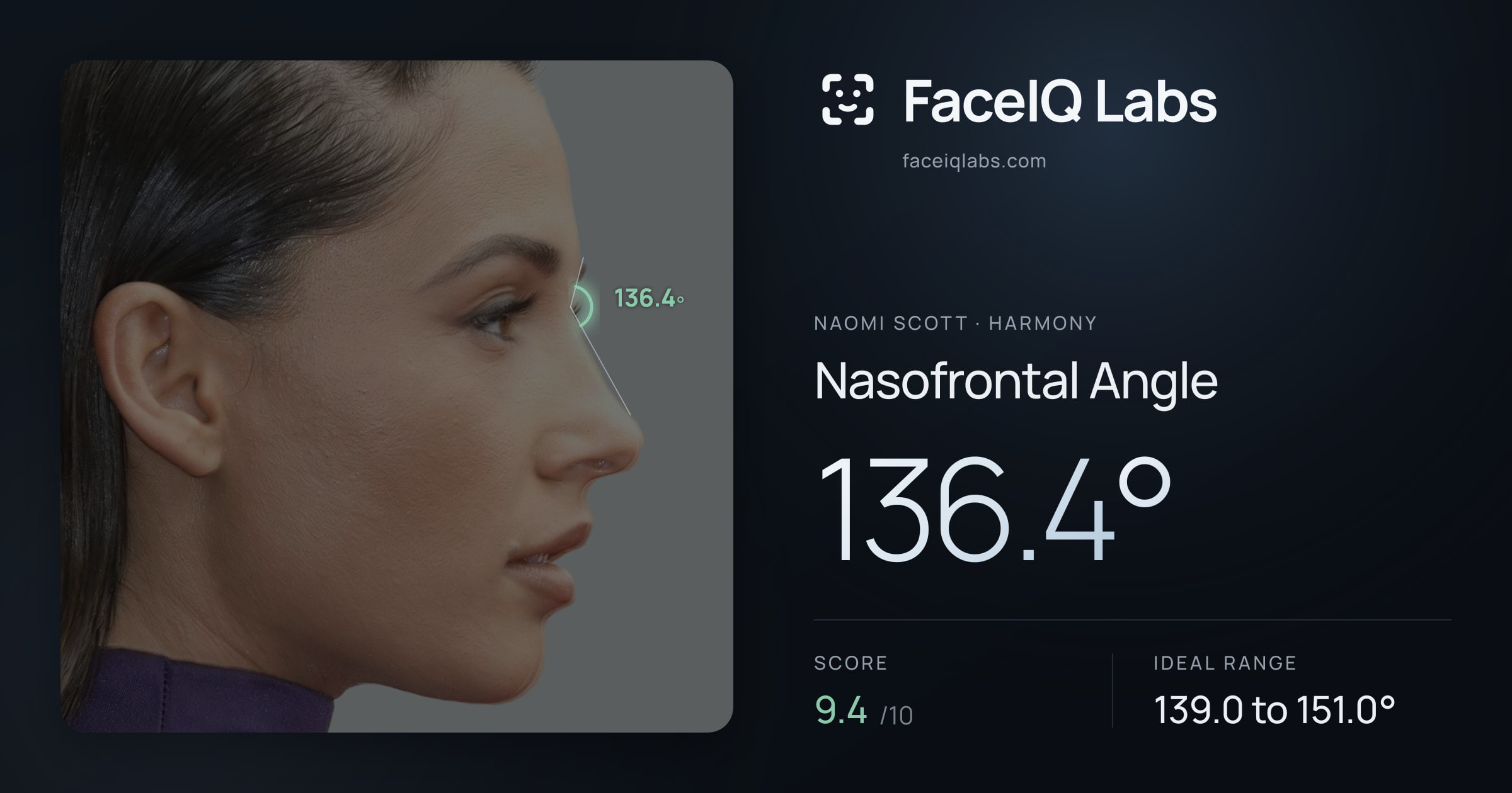 Naomi Scott Nasofrontal Angle: 136.4°, drawn on the photo