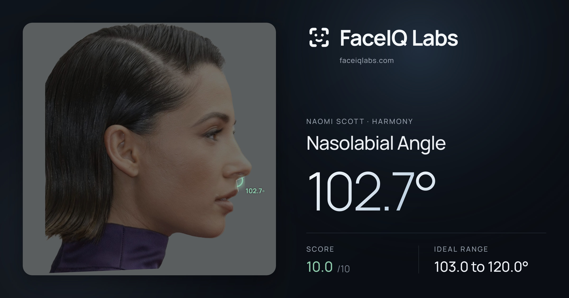 Naomi Scott Nasolabial Angle: 102.7°, drawn on the photo