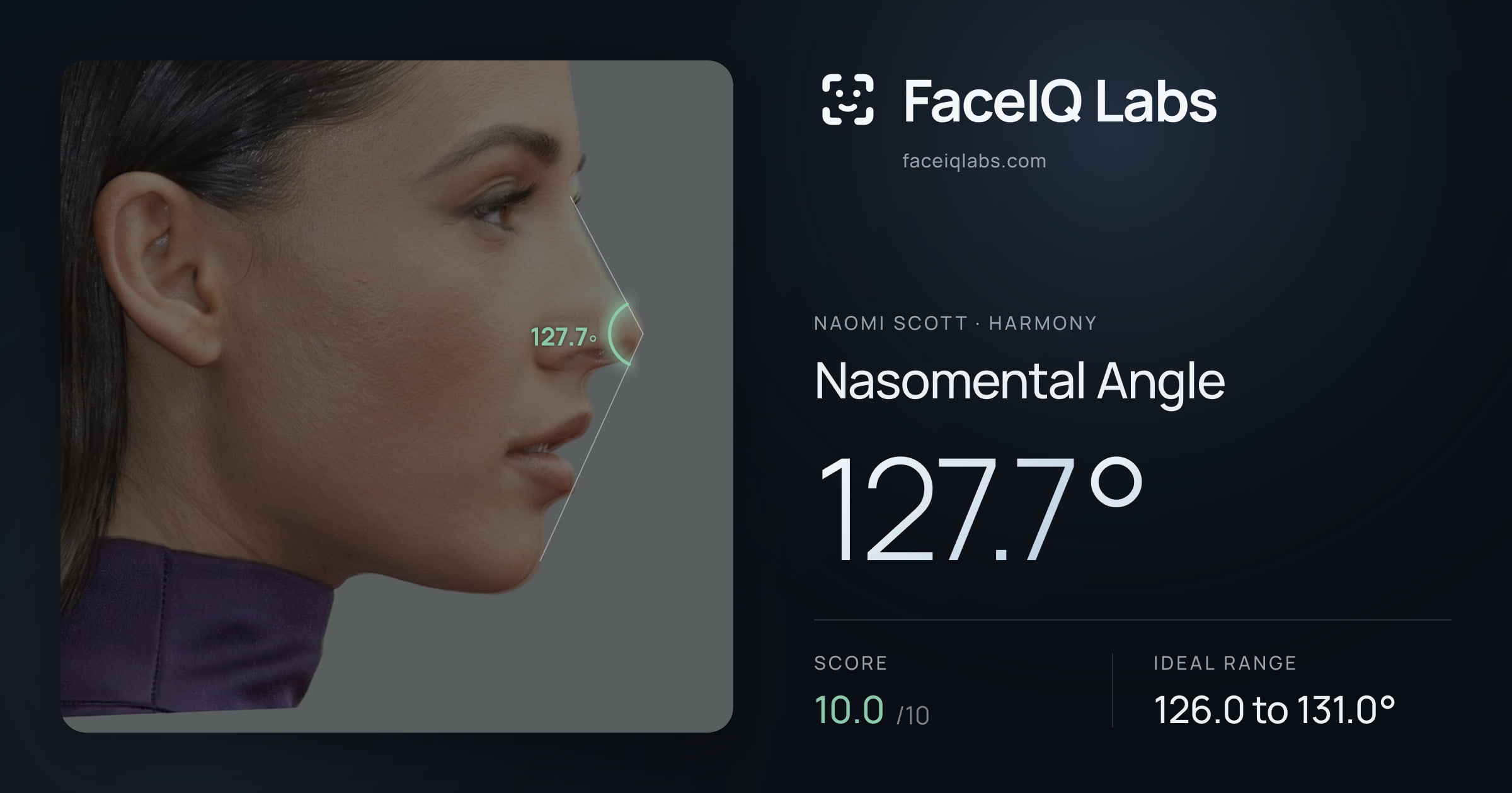 Naomi Scott Nasomental Angle: 127.7°, drawn on the photo