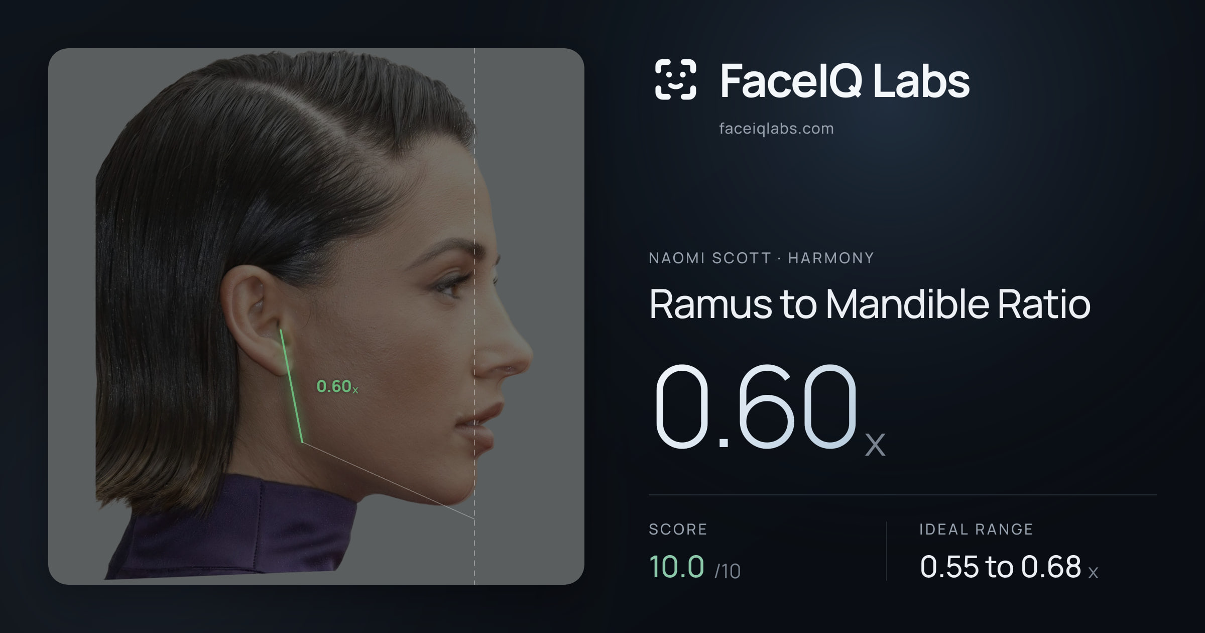 Naomi Scott Ramus to Mandible Ratio: 0.60x, drawn on the photo