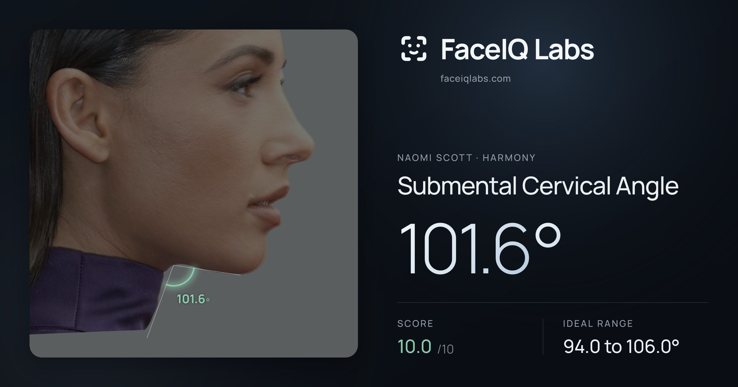 Naomi Scott Submental Cervical Angle: 101.6°, drawn on the photo