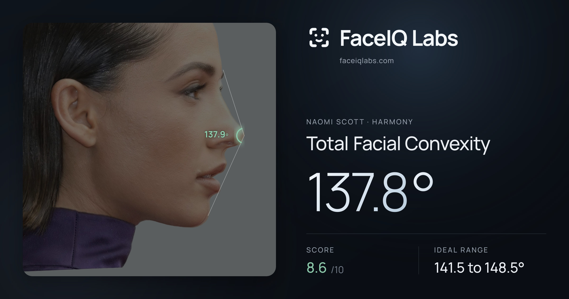 Naomi Scott Total Facial Convexity: 137.8°, drawn on the photo
