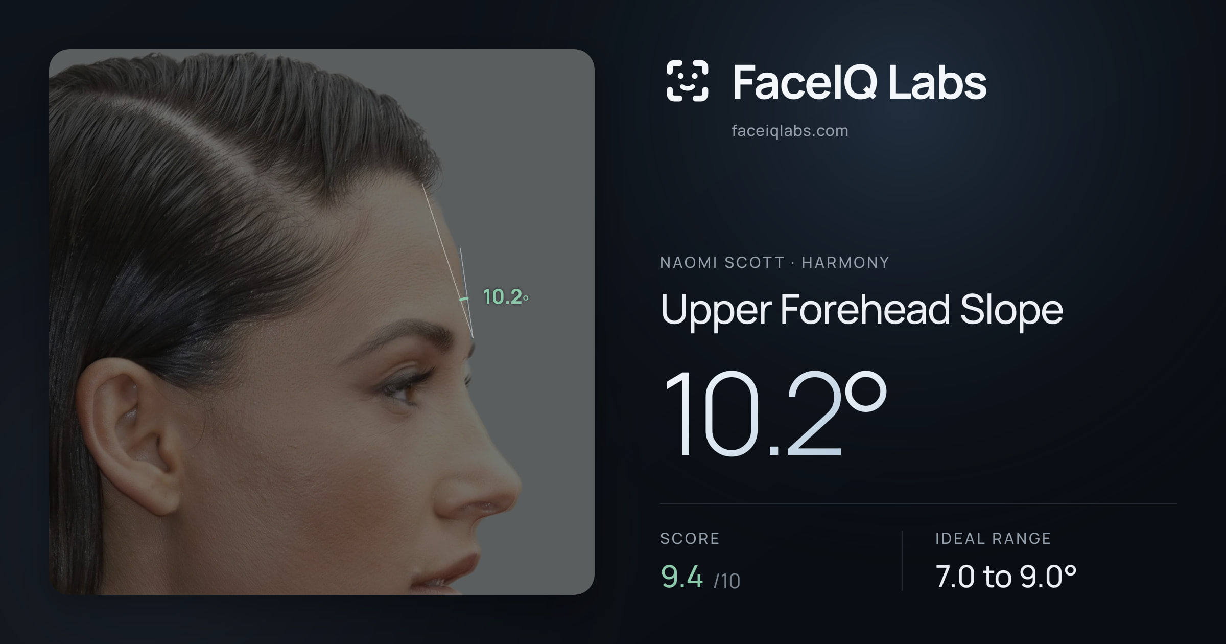 Naomi Scott Upper Forehead Slope: 10.2°, drawn on the photo