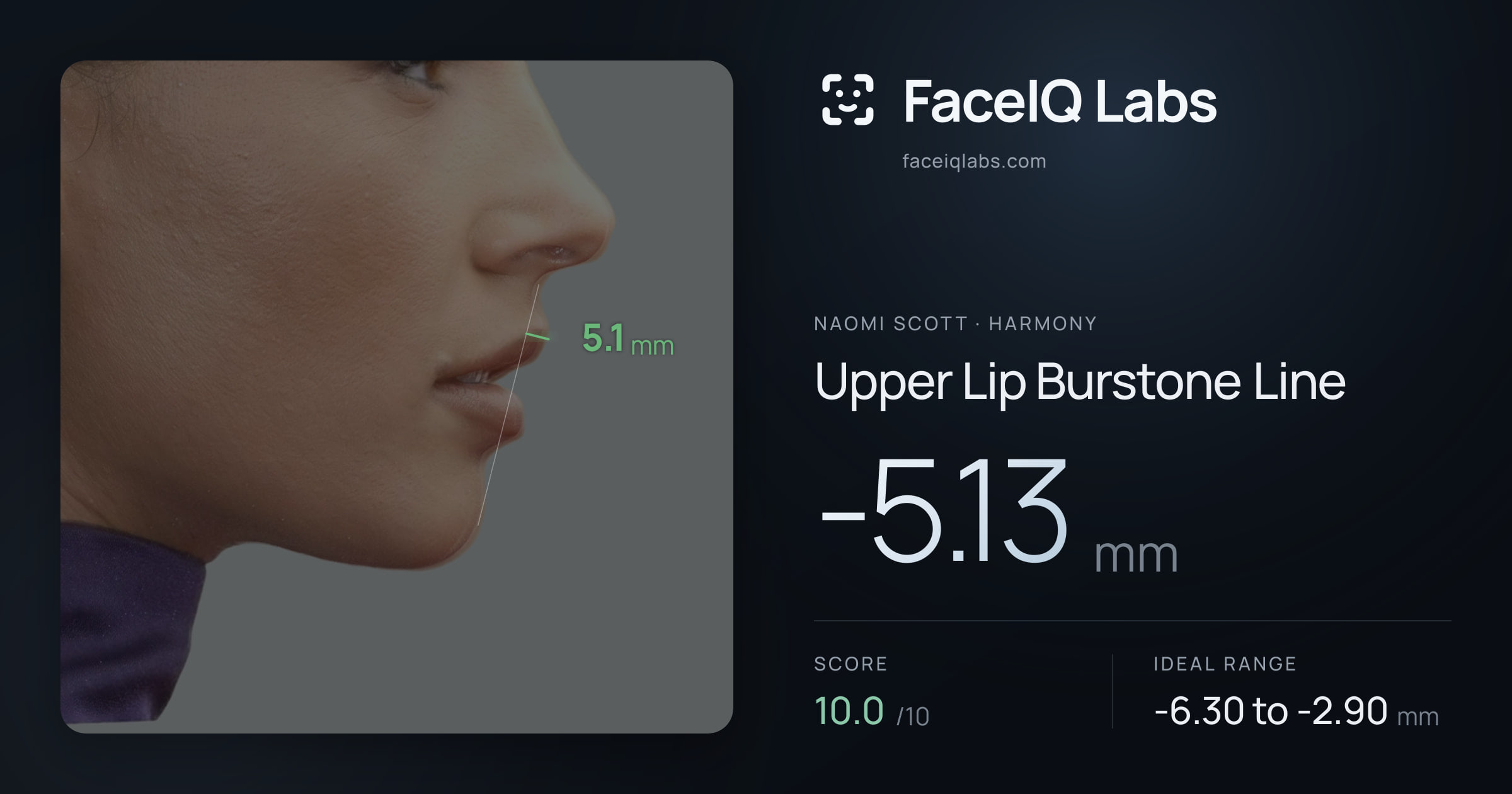 Naomi Scott Upper Lip Burstone Line: -5.13mm, drawn on the photo
