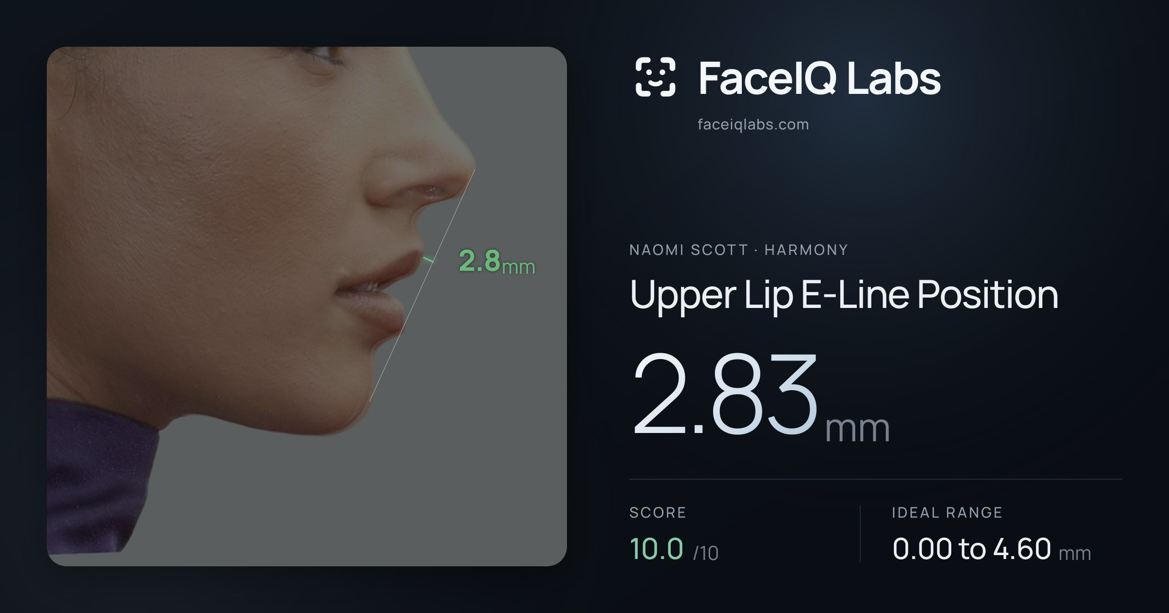 Naomi Scott Upper Lip E-Line Position: 2.83mm, drawn on the photo