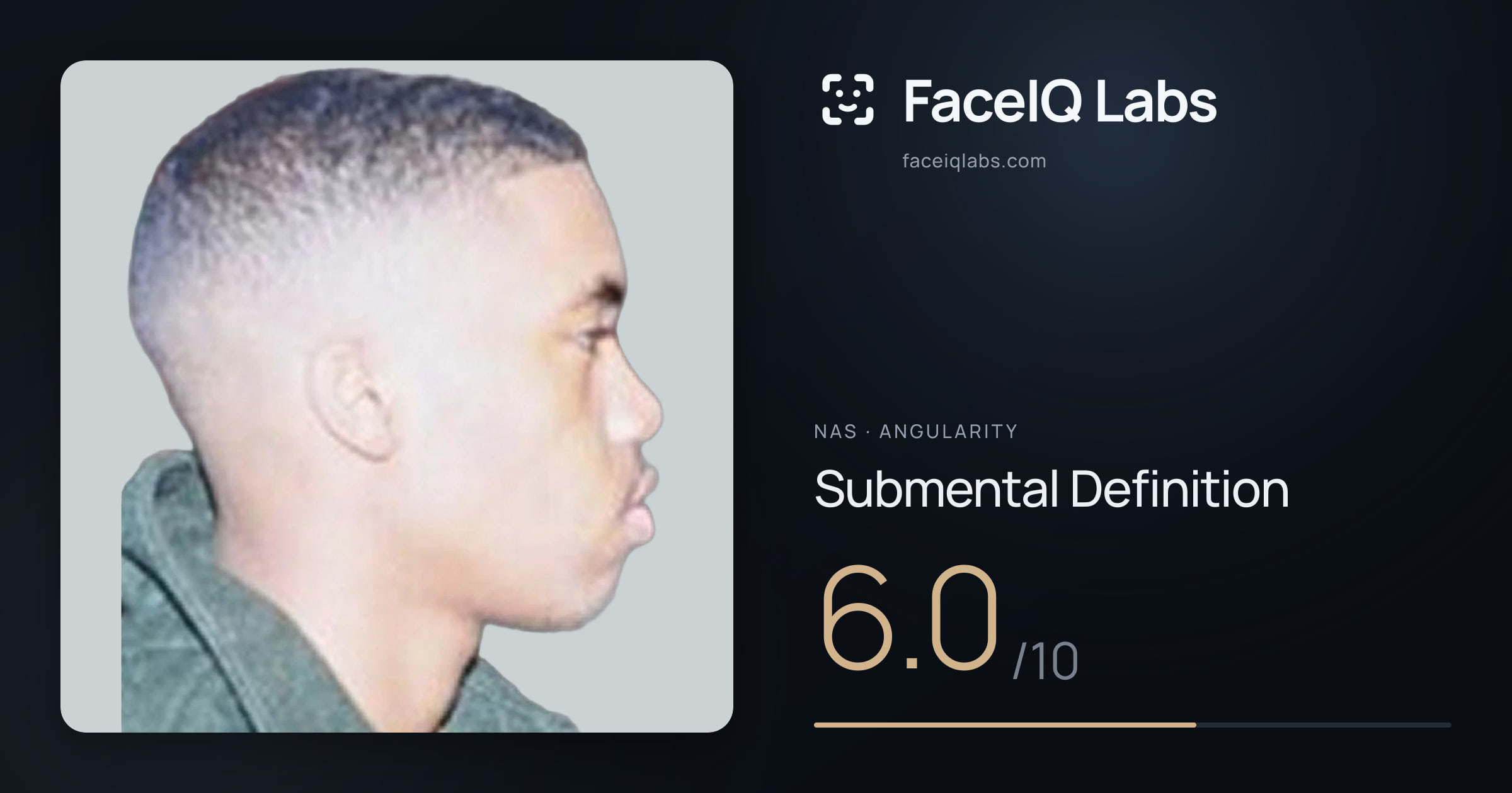 Nas Submental Definition: 6.0/10, drawn on the photo