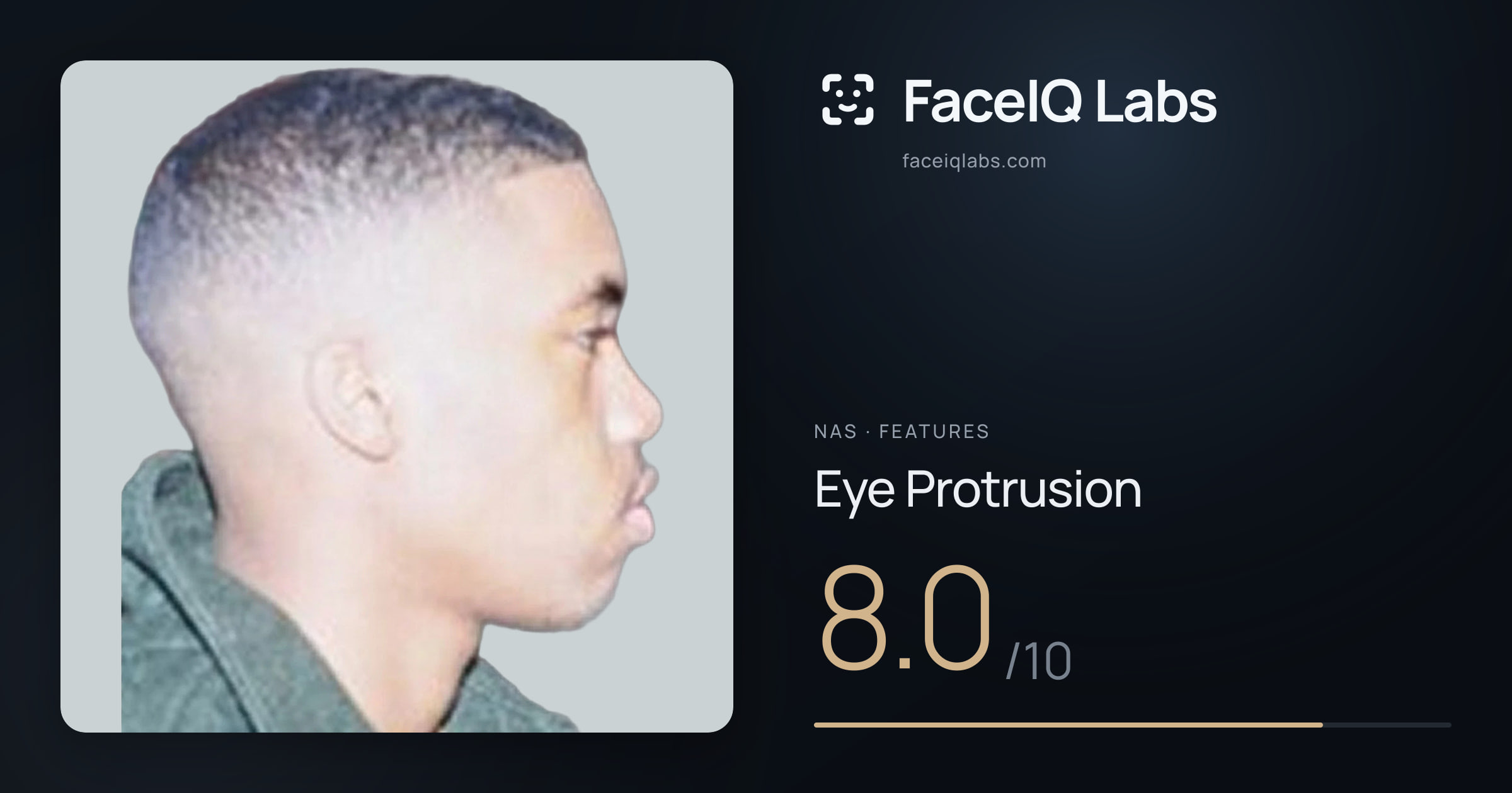 Nas Eye Protrusion: 8.0/10, drawn on the photo