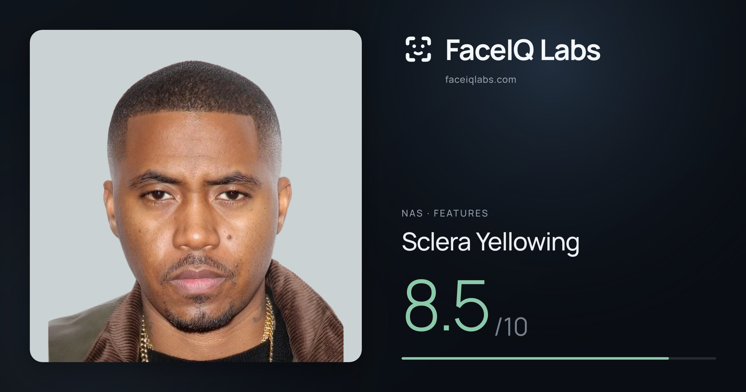 Nas Sclera Yellowing: 8.5/10, drawn on the photo