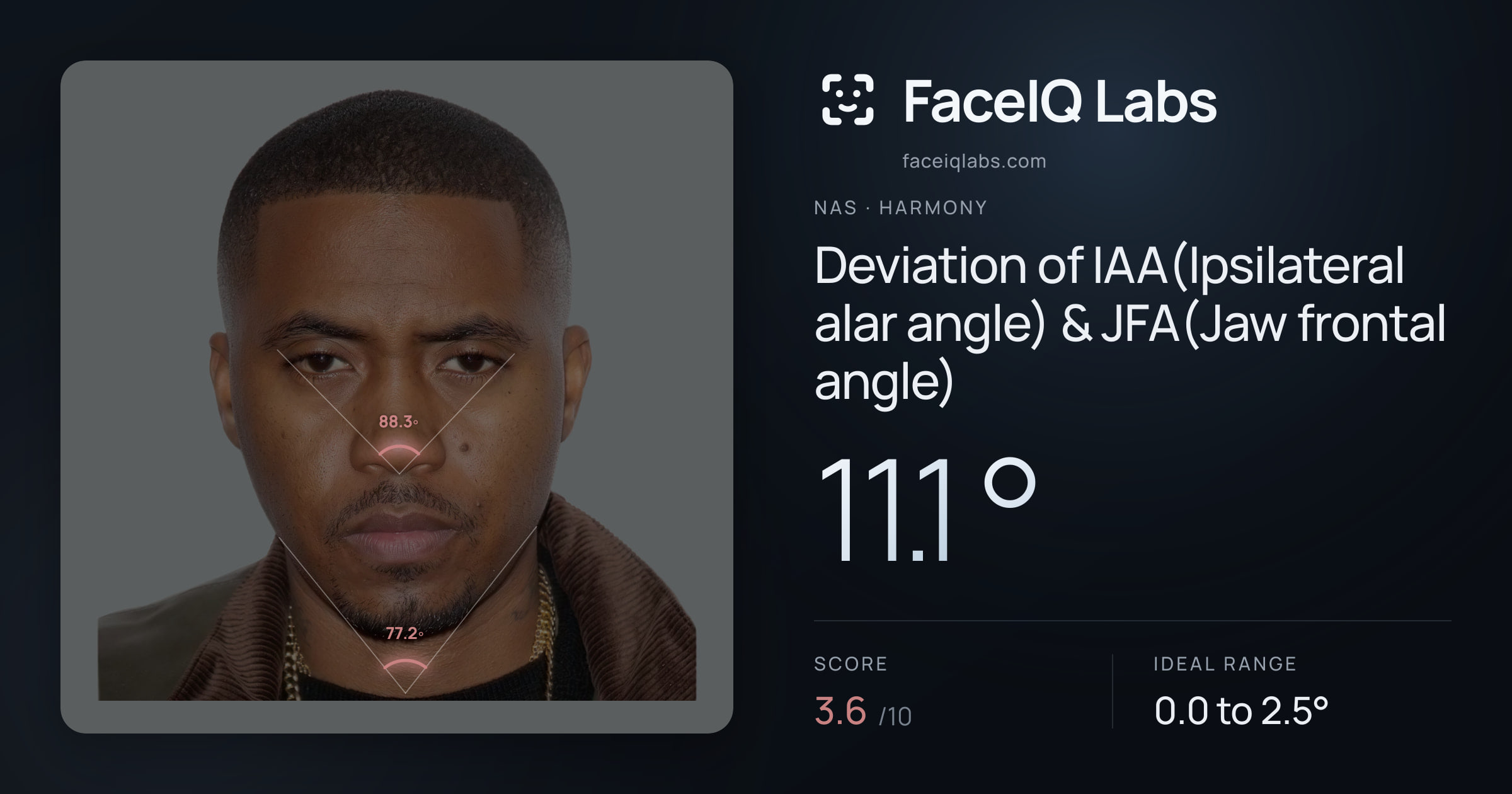 Nas Deviation of IAA(Ipsilateral alar angle) & JFA(Jaw frontal angle): 11.1°, drawn on the photo