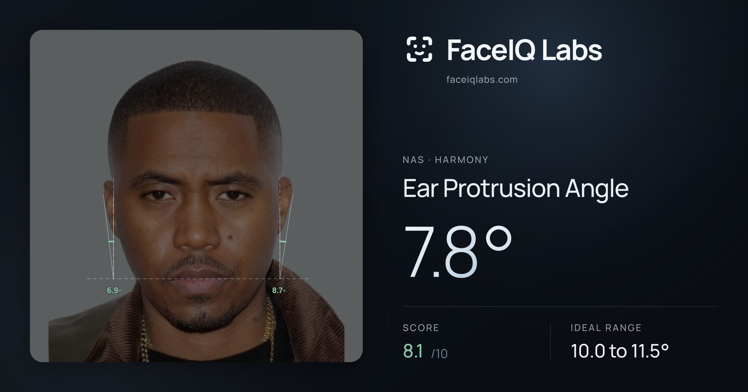 Nas Ear Protrusion Angle: 7.8°, drawn on the photo