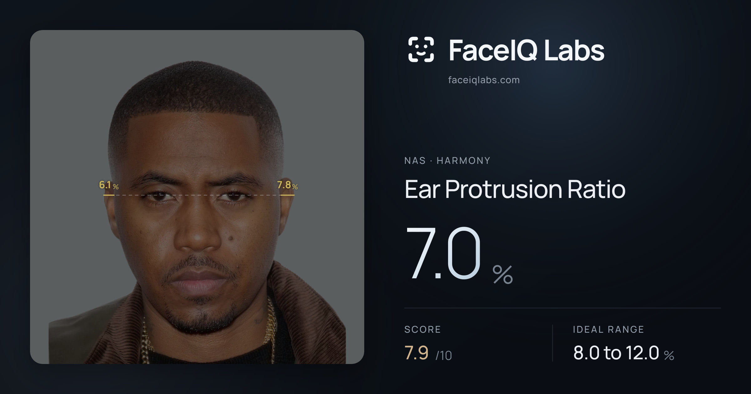 Nas Ear Protrusion Ratio: 7.0%, drawn on the photo