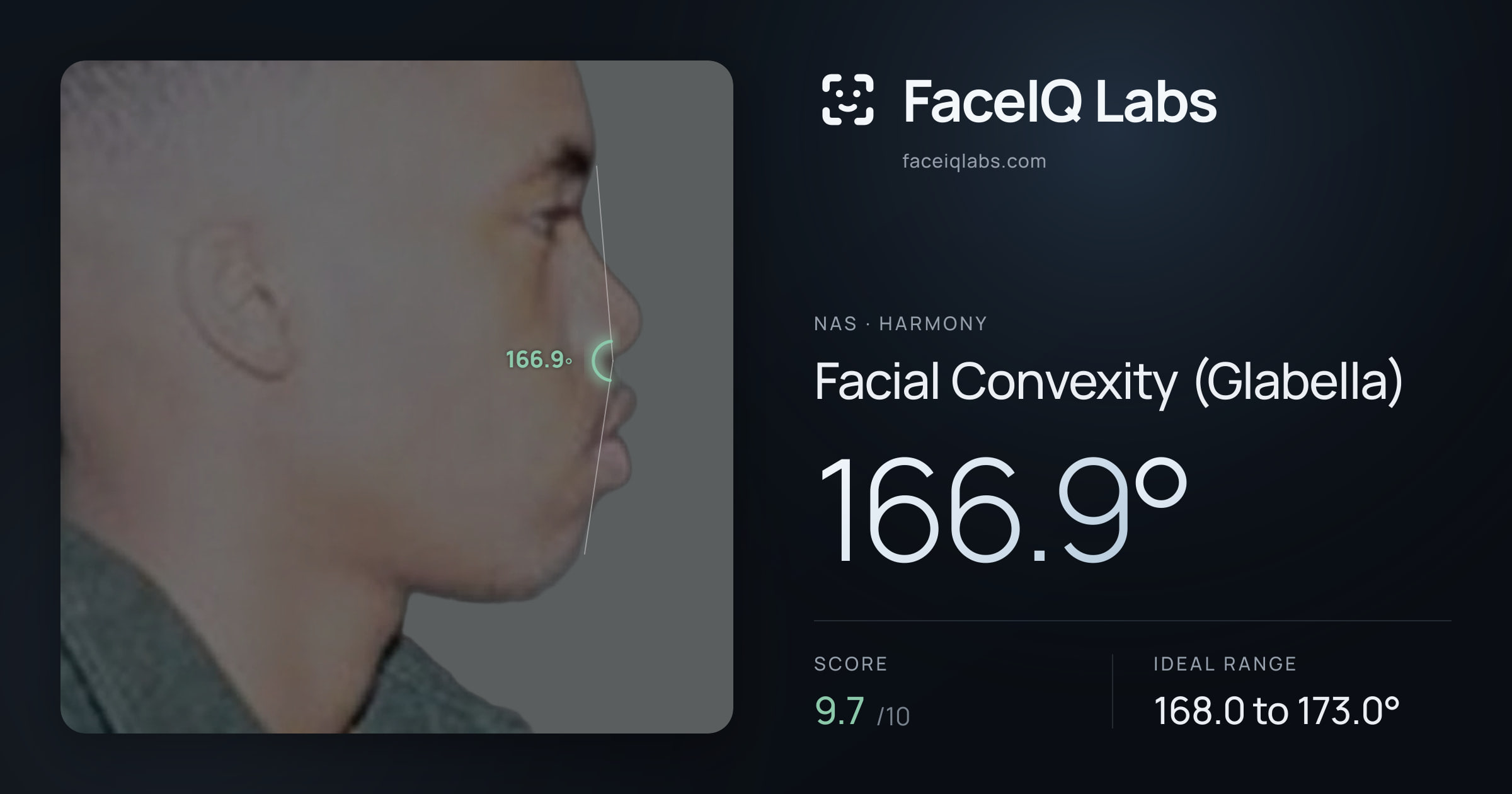 Nas Facial Convexity (Glabella): 166.9°, drawn on the photo