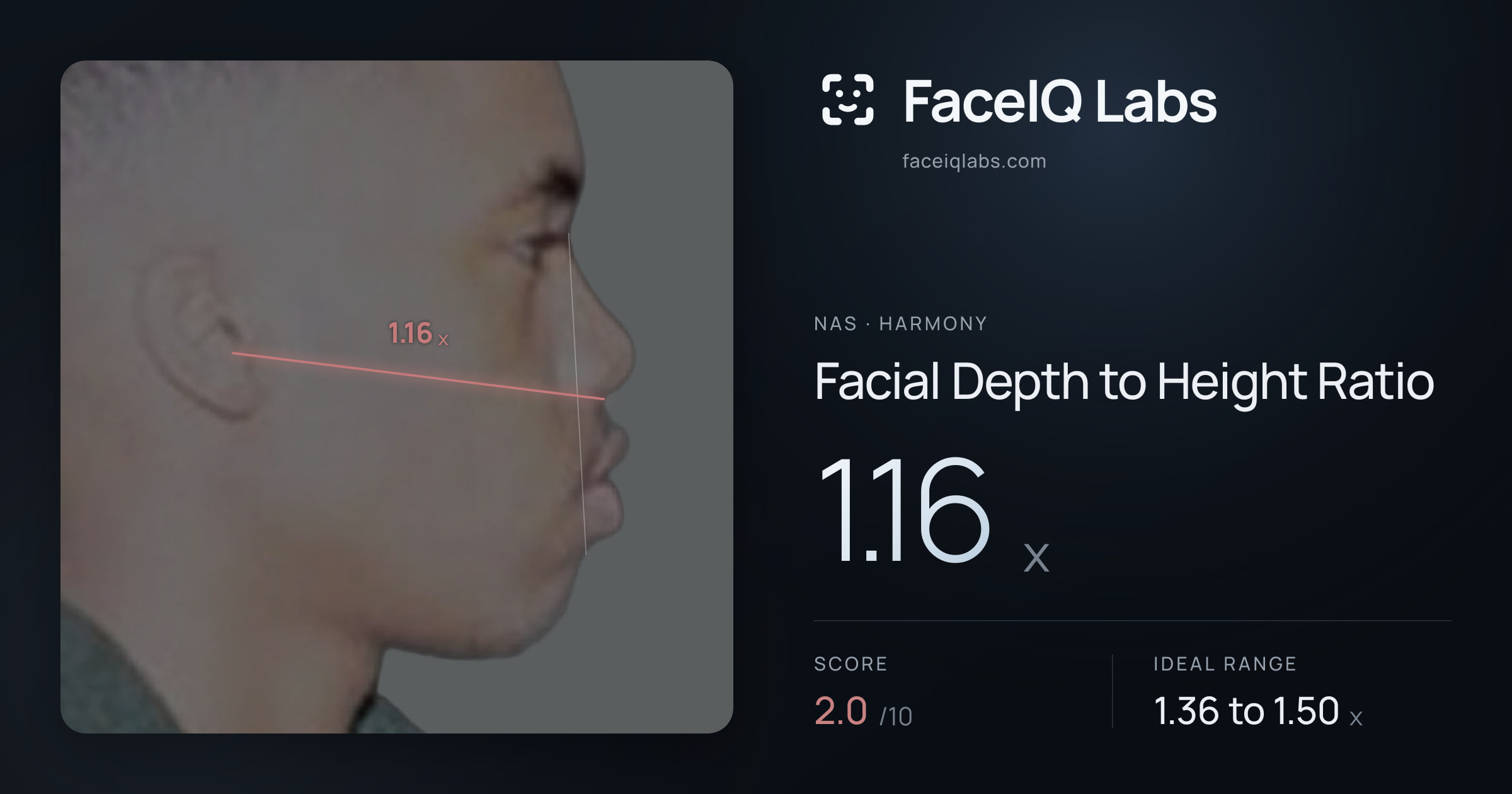 Nas Facial Depth to Height Ratio: 1.16x, drawn on the photo